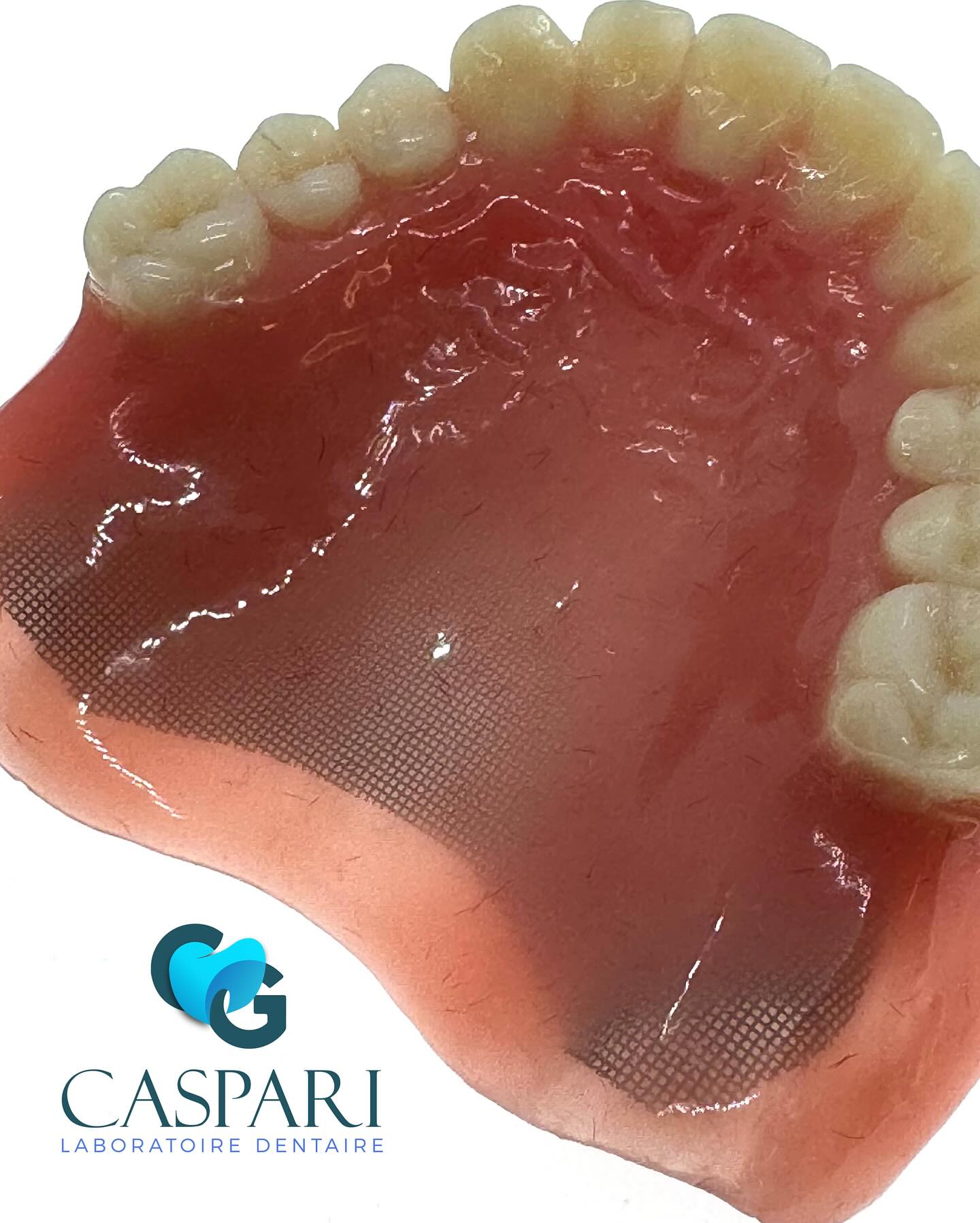 Complet sup avec palais anatomique et grille de renfort.
#prothèsecomplète #anathomie #dent #dentaire #laboratoire #handmade #esteticafacial #estethique #dentaire #dentairesuisse #laboratoiredully #visage #sourir #papilles