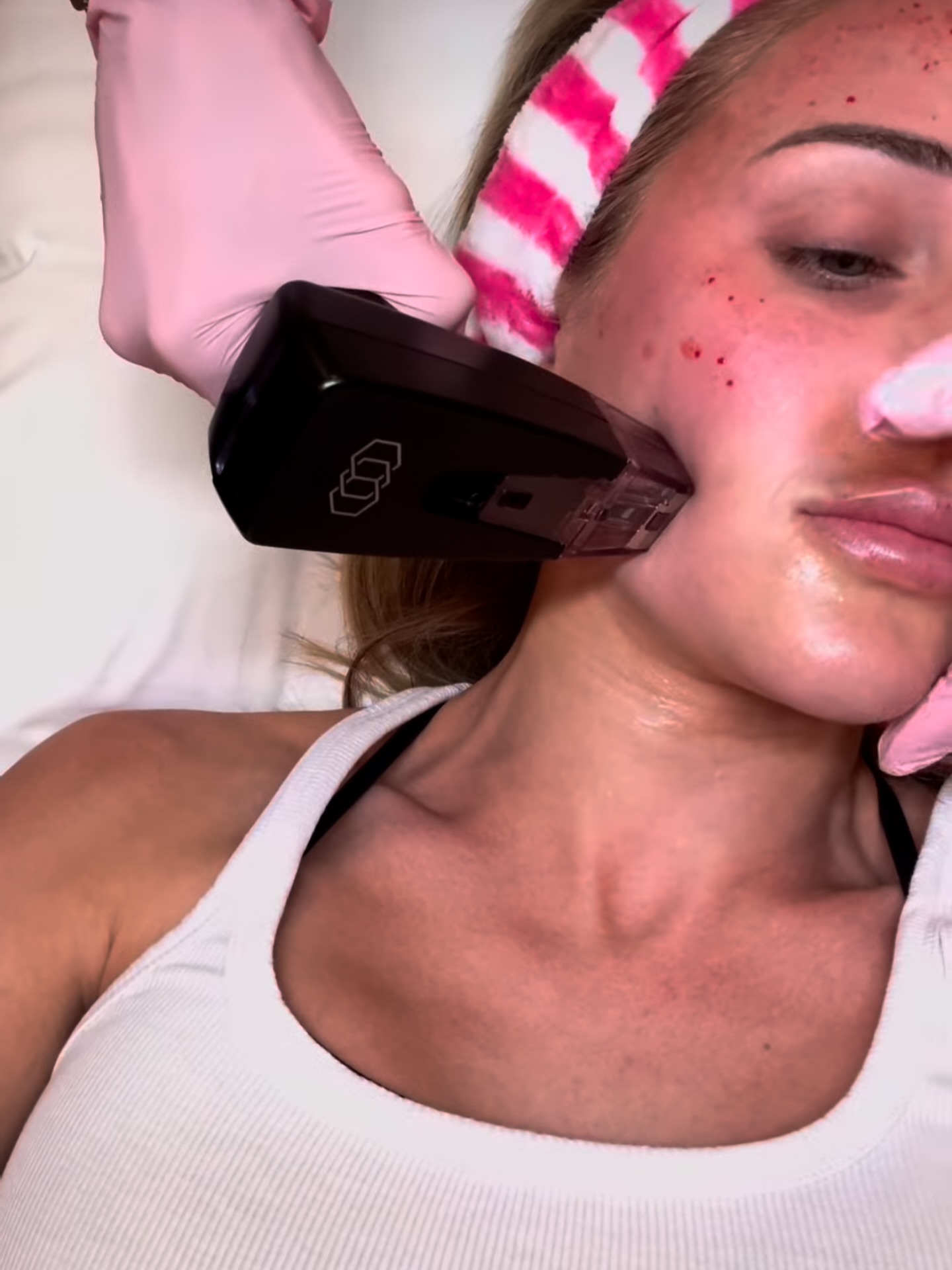 Ready for real results? 🙌 Morpheus8 delivers tighter, younger-looking skin with minimal downtime.
Questions about the procedure? Message us! We are happy to help! 🤩 #morpheus8 #lafayette #skincare #weightloss #aethetics