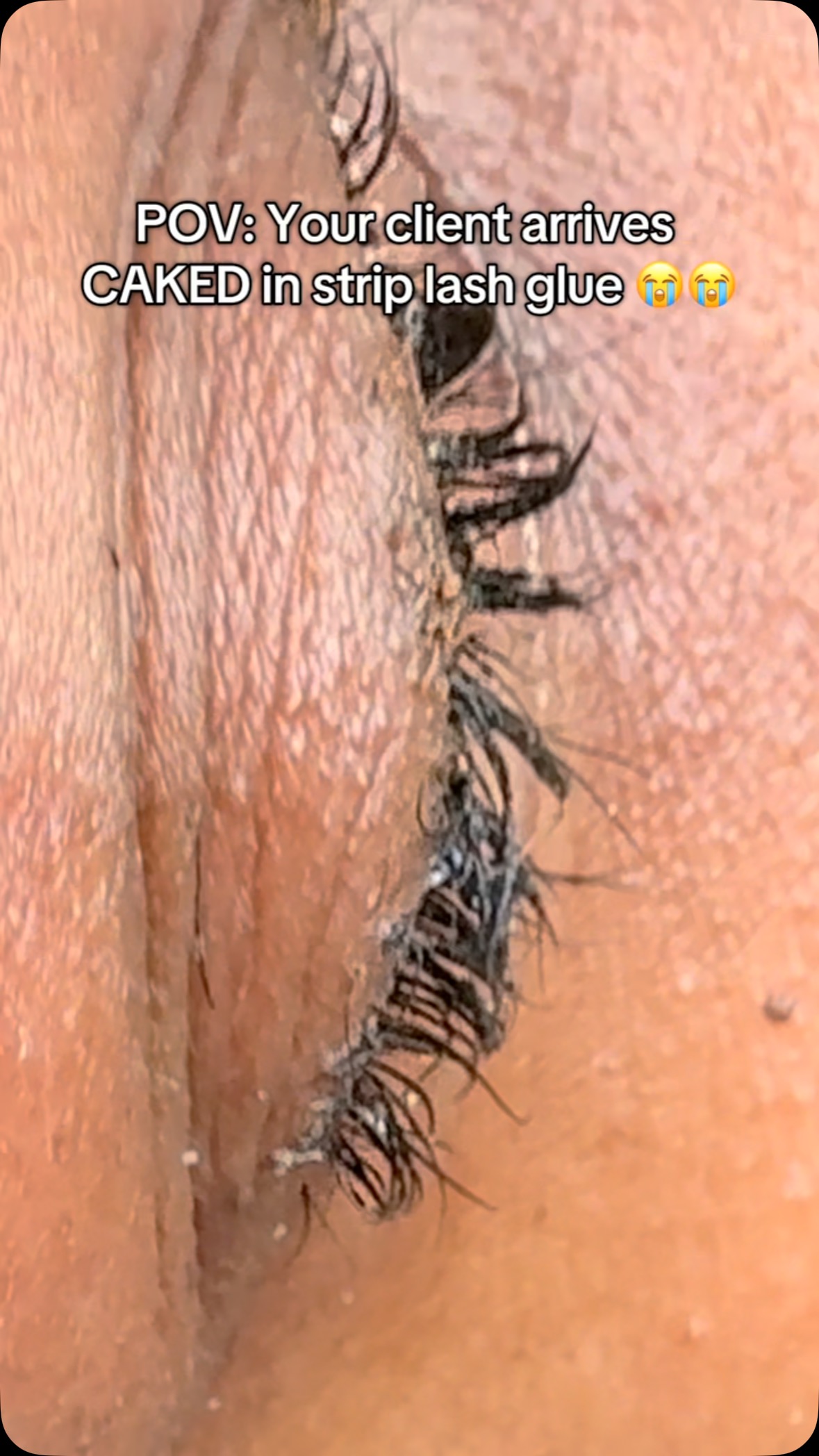 Lash glue nightmare: What would you do? ๐๐
#LashTech #LashDisaster #LashFix #LashExtensionFail #LashGlueGoneWrong #FYP #ForYouPage #ViralLashes #LashTutorial #ClientFromHell