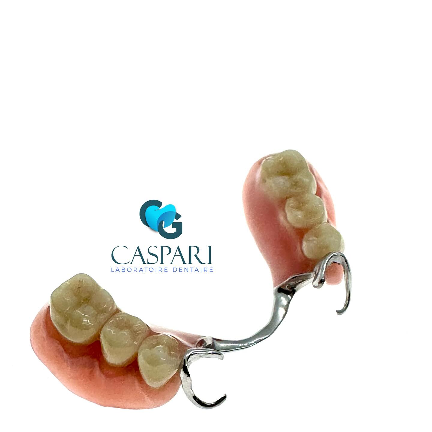 Stellite dentaire #prothesepartielle #amovible #esthetique #esthetiquedentaire #cromecast #cromecobalt #dent #dentaire #techniquedentaire #a3 #bouche #dentairesuisse