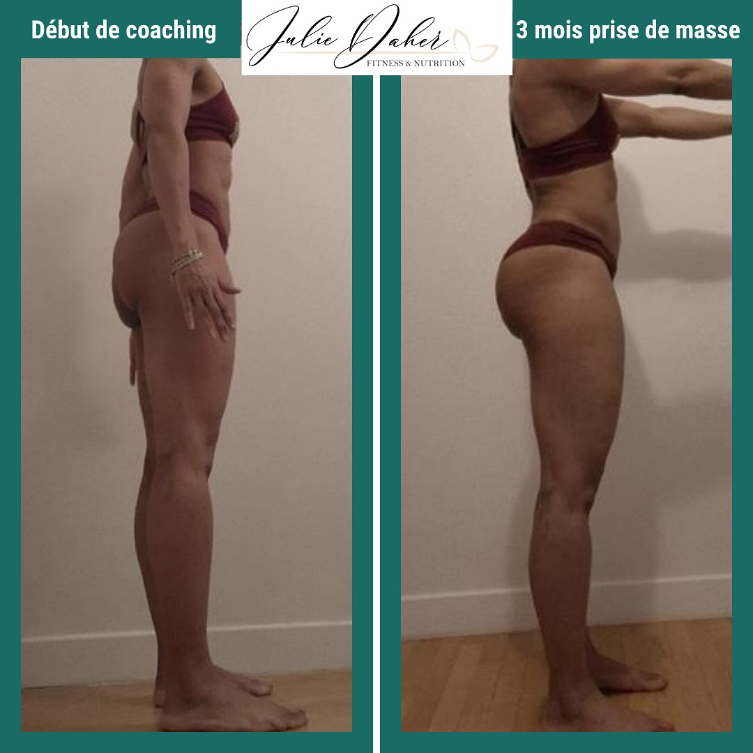 🔥TRANSFORMATION INSPIRANTE 🔥⬇️
Quand ma coachée est venue me voir, son objectif était clair :
👉🏼prendre des fessiers,
👉🏼dessiner un corps plus harmonieux,
👉🏼rester féminine, sans prise de gras inutile.
Elle en avait assez des programmes génériques ou peu adaptés, malgré le fait d’avoir été suivie par un coach dans le passé … mais avec un haut du corps très développé et un bas du corps en retard. Résultat : un physique déséquilibré, des frustrations… et toujours cette impression de ne pas manger assez sans comprendre pourquoi.
En 3 mois de coaching personnalisé, voilà ce qu’on a mis en place ensemble :
✅ Un plan alimentaire sur mesure, à 2950 kcal/jour (soit +900 kcal vs. avant !)
✅ Un programme d’entraînement pensé pour cibler efficacement le bas du corps, avec une vraie stratégie de progression
✅ Un accompagnement pour lui apprendre à manger enfin en quantité suffisante, sans peur de “trop manger” et sans se sentir affamée
🎯 Résultats ?
✨ +4 cm de fessiers visibles (sans BBL, juste du vrai taff)
✨ +4 kg mais principalement de masse maigre, presque pas de gras
✨ Un corps plus sculpté, plus féminin, plus fort
✨ Une relation apaisée avec la nourriture
Voici ce qu’elle en dit :
🗣️ « Julie a su être à l’écoute de mes attentes sportives et nutritionnelles. Comme c’est une femme, elle comprend exactement les subtilités de la prise de masse féminine. J’ai pris de la masse musculaire tout en limitant la prise de gras. Les résultats sont vraiment visibles. Merci Julie, et ce n’est que le début ! »
On a encore prévue de continuer la prise de masse, puis on partira sur une mini cut ! Le meilleur est à venir 👏🏼💪🏼
🌟 Oui, on peut construire un corps fort ET féminin.
🌟 Oui, on peut manger plus, prendre du muscle sans devenir Hulk, et se sentir bien dans son corps.
🌟 Oui, un bon suivi change tout.
📩 Tu veux toi aussi des résultats visibles ? Écris-moi en DM le mot « Transfo » pour commencer ton parcours 💪🏼✨.
#transformationphysique #musculationfemme #coachsportif #fitnessmotivation #nutritionsportive #bodygoals #leanbulk #prisedemasse #bootygains #fitnesstransformation #musculation #bodybuilding