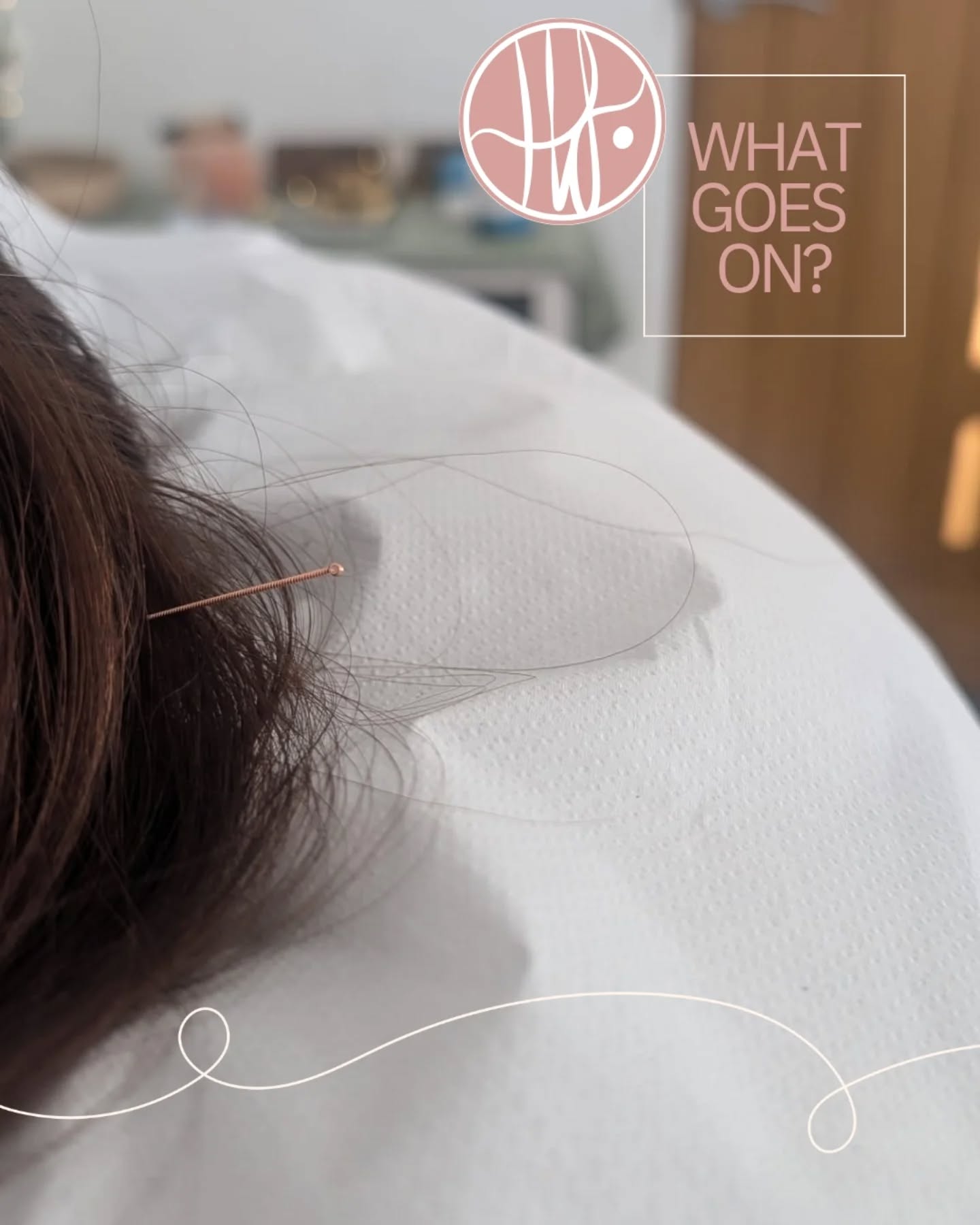 What actually goes on in a treatment?
Following on from your Fertility or Women's Health Consultation are your follow up appointments.
Each follow up appointment is 60 minutes long. We always begin with a cosy herbal tea and chat. Talking through how you've been feeling physically and emotionally. With these signs & symptoms in mind I also check in on your tongue and pulse diagnostics to guide my treatment.
Then it's time to sink into the bed as I gently needle, guided by breathwork. I often blend in other therapies where needed like:
š±Moxabustion
š±Cupping
š±Reiki
š± Womb Massage
š± Reflexology
š± Guided Meditation
#fertilityacupuncture
#womenswellness
#periodproblems
#gynaehealth
#pregnacyafterloss
#ttcishard
#moxa
#reproductivereflexology
#reikitocalm
#restanddigest
#calmthenervoussystem