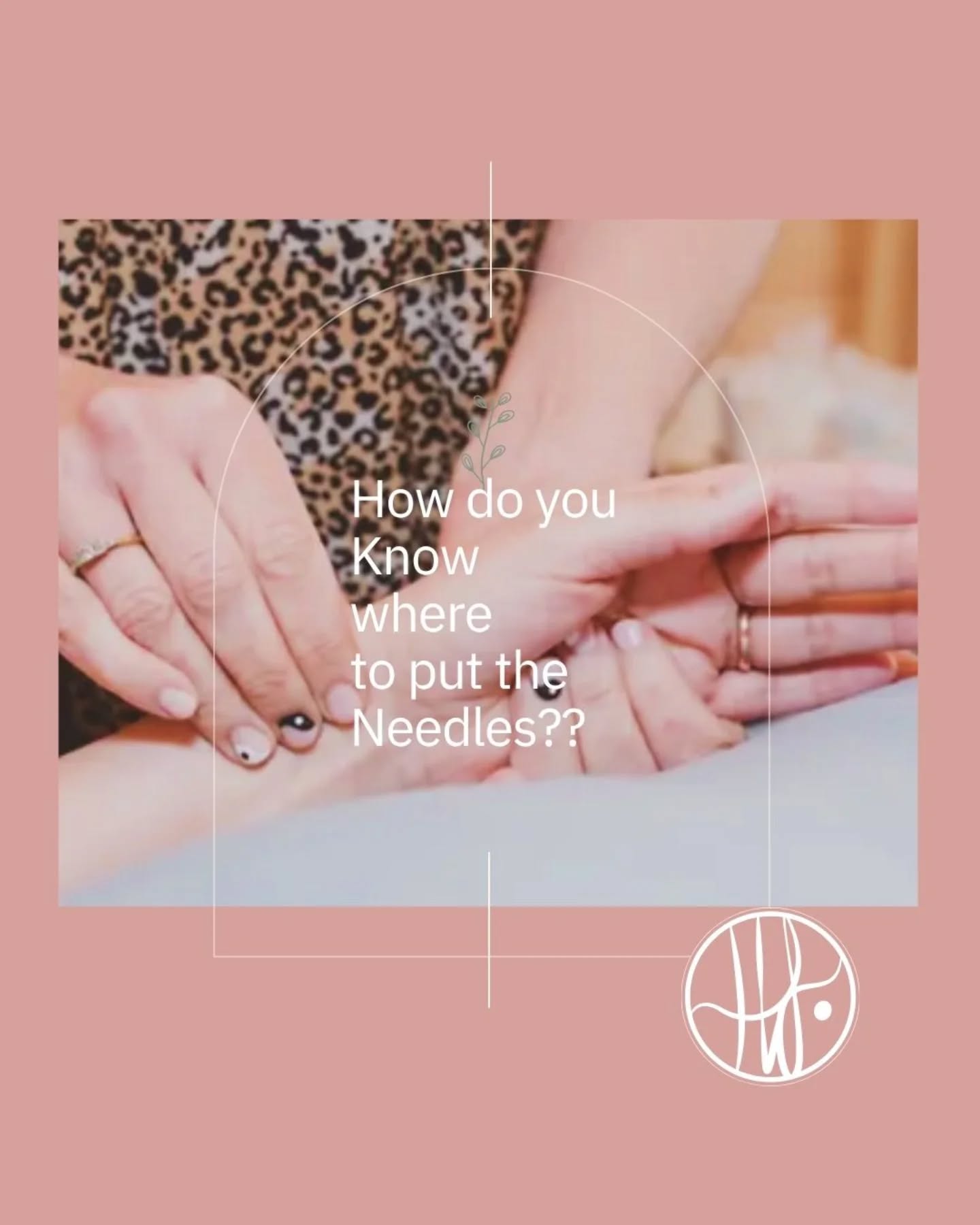 "How do I know where to put the needles"
A common question I get asked in clinic......
š± We start with your full story. Thatās why your first Fertility or Womenās Health Consultation begins with a detailed intake ā exploring your history, symptoms, and overall wellbeing.
š± I also check your tongue and pulses (classic TCM tools!) your test results and BBT charts if you have them. This then allows me to create a personalised diagnosis and treatment plan tailored just for you.
š± Once I have nailed your diagnosis this guides where your needles will be placed.
š± As a cyclical woman we also take into consideration each phase of your menstrual cycle or the role of the IVF medication I am working to support too.
š± Your diagnosis evolves as we move through your treatment plan.
#ihearttcm
#ancienthealing
#fertilityacupuncture
#ivfwarrior
#stillnotpregnant
#ttcnaturally
#assistedfertility
#ivfbaby
#chinesemedicineworks