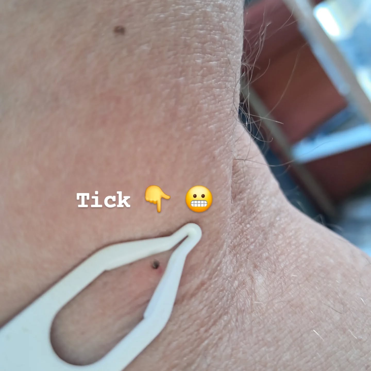 Summer season is tick season.
If your planning a trip in the wilderness whether it's canoeing or hikeing ticks are out there to get a free ride. To remove the pesty things I highly recommend a tick remover called "Tick 2"
We sell them now for 50 SEK which may sound expensive for a piece of plastic, but I have had mine for 10 years or so and moved an average of 15 ticks a year...not so expensive then if you think about it, is it ?
PS
fyi you should never use tweeezers to remove ticks ‼️
#markaryd #småland
#laholm #lagaleden #outdoor #camping #wilderness #tick #kanot #kano #canoe #camping
