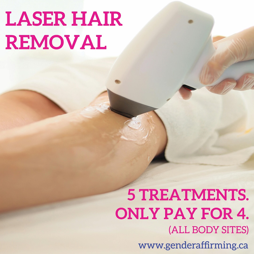 LASER HAIR REMOVAL SPECIAL. Get 5 treatments for the price of 4!!
Now taking bookings at www.genderaffirming.ca
If you have any questions, feel free to DM us!
www.safersix.ca
#toronto #the6ix