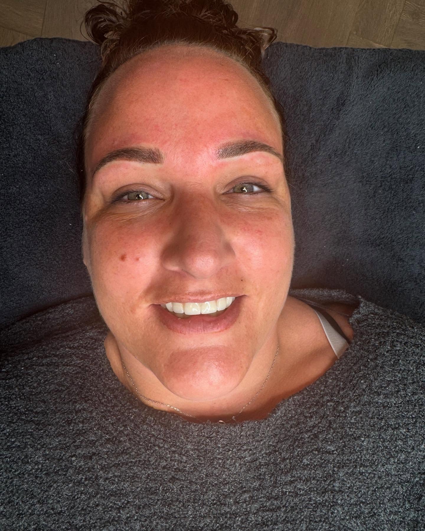 ✨ Powderbrows Voor & Na ✨
Swipe 👉 om het resultaat van mijn Powderbrows-behandeling te zien!
Bij mij zie je geen filters of bewerkingen — gewoon puur en eerlijk het resultaat na de behandeling.
💛 Voordelen van Powderbrows:
✔️ Zachte, poederachtige look voor een natuurlijk resultaat
✔️ Minder invasief dan microblading
✔️ Geschikt voor alle huidtypes, ook vette huid
✔️ Langdurig resultaat (1,5 tot 3 jaar)
✔️ Frisse, verzorgde wenkbrauwen zonder dagelijks bijtekenen
✔️ Subtiele opbouw van kleur en intensiteit
✔️ Sneller genezingsproces dan bij hairstrokes
📸 Ik deel altijd échte resultaten, zodat je precies weet wat je kunt verwachten. Wil je meer weten of een afspraak maken? Stuur me gerust een DM! 💌
Www.sdibrows.nl 06-31763025
#inklessstretchmarksremoval #permanentmakeuplippen #permanentemakeup #pmu #pigment #wenkbrauwen #brows #browbar #sdibrows #miainkt #hairpigmentation #heerhugowaard #oudkarspel #Alkmaar #Noord-Holland #powderbrows #lipblush #lippigmentatie #academy #opleidingen # cursussen #microdermabrasie #microneedling #wax# #fullbodywax
