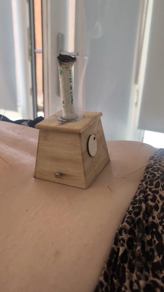 Another full and meaningful week in clinic, supporting men & women through all stages of their reproductive journeys. This week, Iāve treated and supported those navigating:
⨠Adenomyosis
𩸠Heavy & painful periods
š£ PMT & PMDD
š Irregular cycles
šø Endometriosis
āļø Frozen embryo transfer prep
š¤ Pregnancy after loss
𤰠First & second trimester care
š Unexplained infertility
ā³ TTC over 40
š¤ Two-week wait support
Each journey is unique, and Iām here to walk beside you with compassion, care, and evidence-based support. š
#WomensHealth #FertilitySupport #EndometriosisAwareness #TTCCommunity #PregnancySupport #HormoneHealth #CycleCare #ReproductiveHealth #HolisticWomensHealth