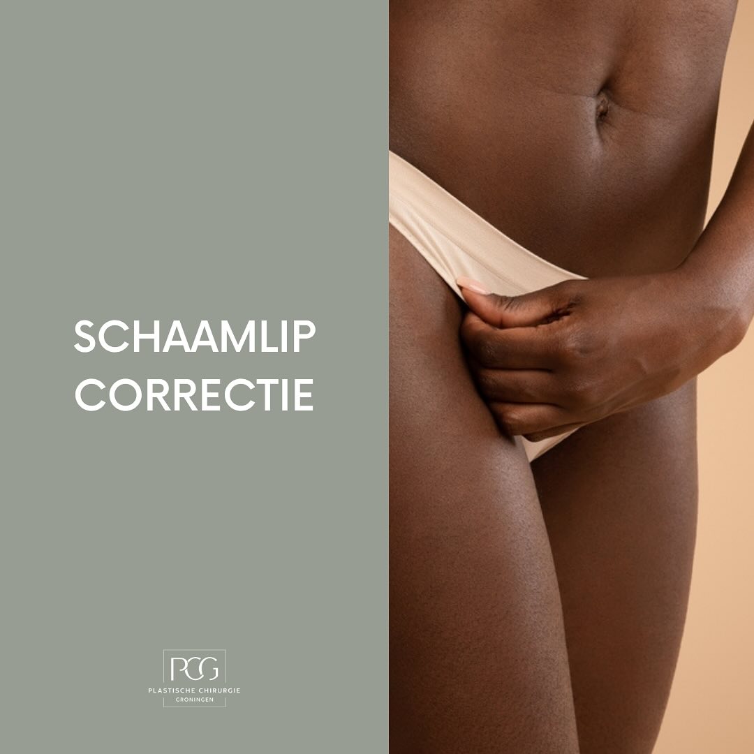 Schaamlipcorrectie: kleine ingreep, groot verschil ✨
Sommige vrouwen ervaren ongemak bij het fietsen, sporten of in strakke kleding. Of doen het voor hun eigen gevoel van zelfvertrouwen.
Het is een persoonlijke beslissing en bij ons sta jij centraal: met aandacht, begrip en deskundige zorg!
📲: 050 211 04 96
📧: info@pcgroningen.nl
