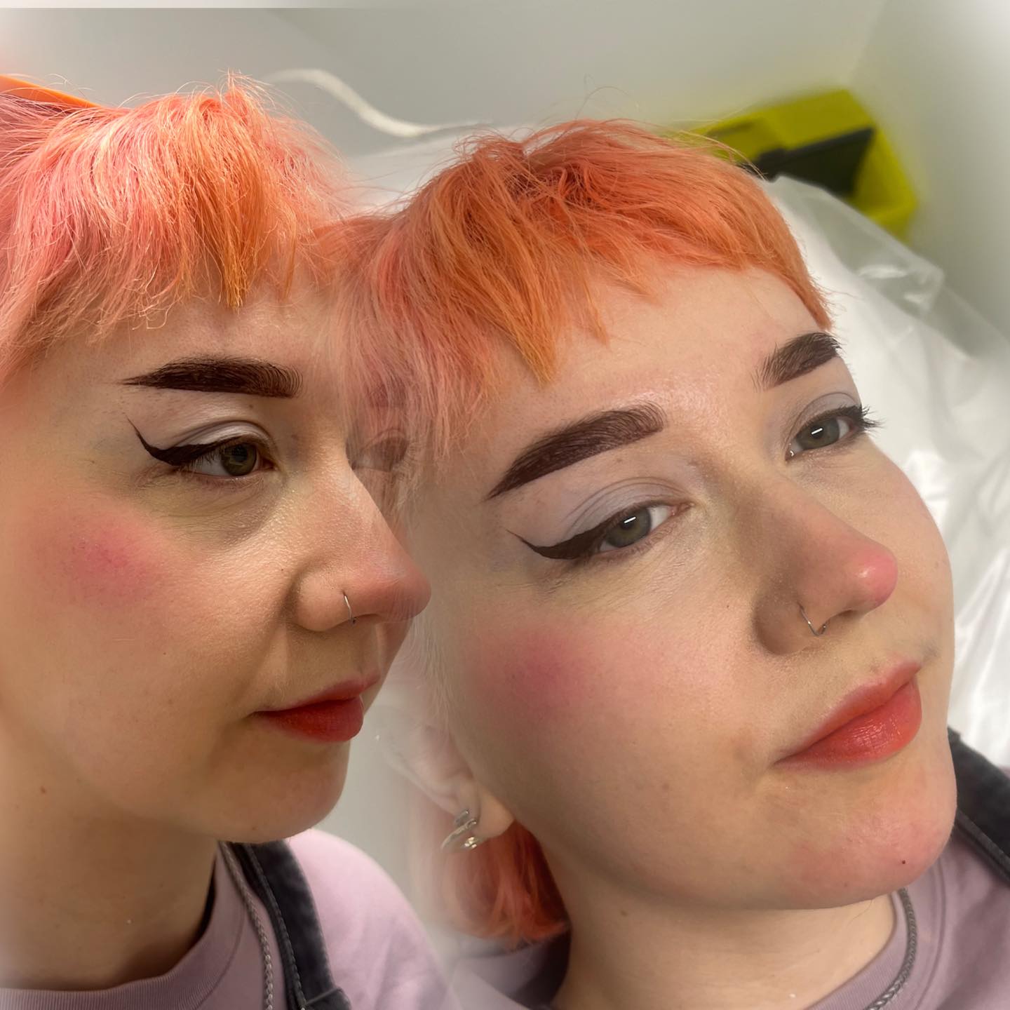 ๐ 1ML Dermal Filler for ONLY ยฃ99! ๐
This beauty came in for her consultation and chose to enhance her chin profile โ creating a more balanced and defined look! The results? Subtle yet stunning. โจ
Everyoneโs face is different, and thatโs why we offer a bespoke consultation to find the perfect placement for YOU.
Ready to enhance your natural beauty? Book now
#TheBeautyLabNorthEast #ChinFiller #DermalFiller #FacialBalancing #SubtleEnhancement #BeautyOffer #ProfileGoals #AestheticsUK #GlowUp #FillerBeforeAndAfter #EnhanceYourFeatures #ยฃ99Filler #AestheticClinic #northeastbeauty