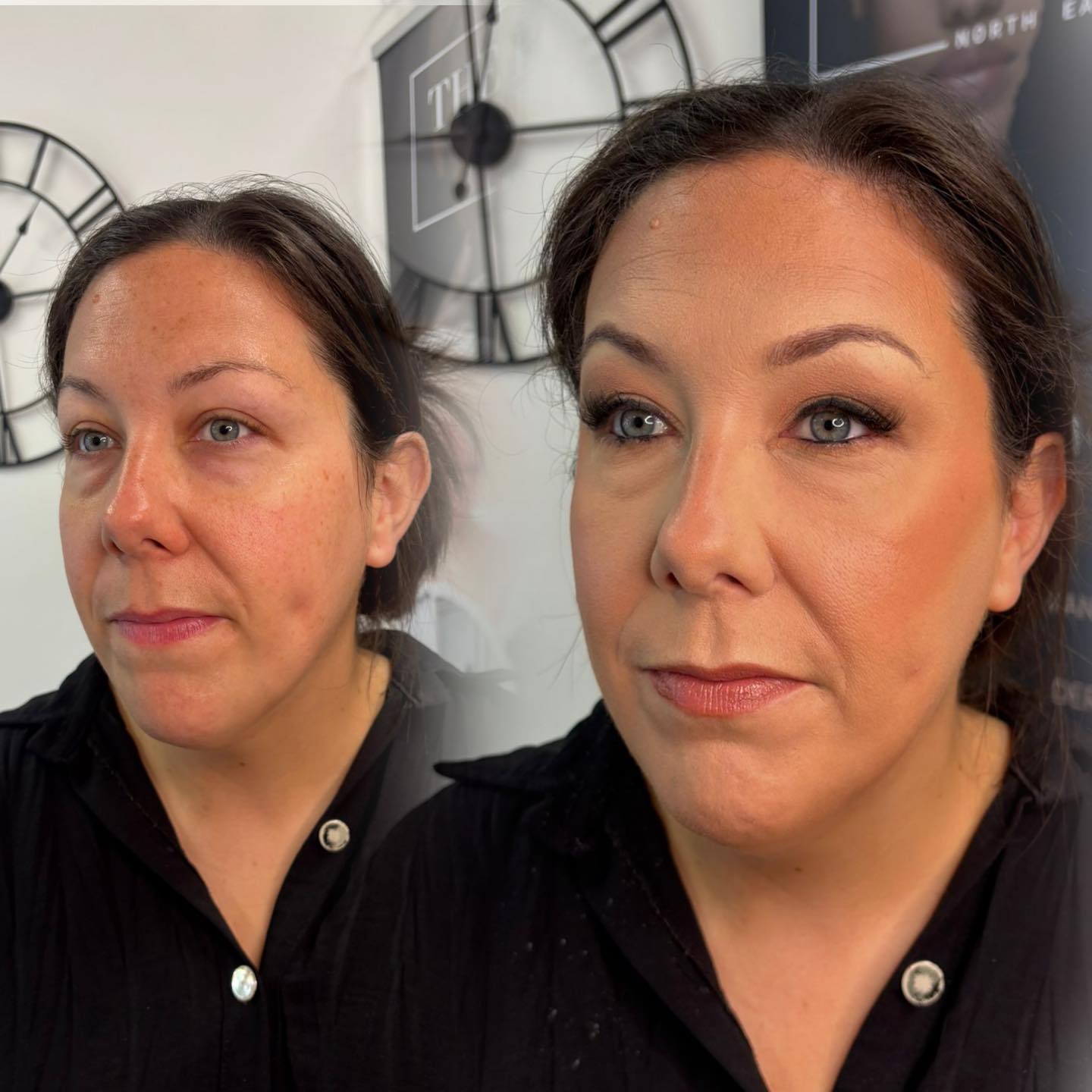 ๐โจ Beautiful, beautiful, STUNNING results for this gorgeous lady yesterday at The Beauty Lab North East โ just look at that glow! ๐
Amazing work by our super talented Amber yet again ๐๐ฅ
Whether itโs a glam night out, a special occasion, or just a well-deserved treat โ weโve got your makeup needs covered ๐
๐
Ready to turn heads?
โจBook your makeup appointment now โจ
#MakeupByAmber #TheBeautyLabNorthEast #FlawlessFinish #GlamGoals #MakeupMagic #BeautyClinic #NorthEastMakeupArtist #StunningResults #SpecialOccasionMakeup #MakeupTransformation #GlowUp #BeautyLabBabe #MUA #BookNow #GetTheLook #NorthEastBeauty
๐ Tag a friend who needs their glam fix! ๐