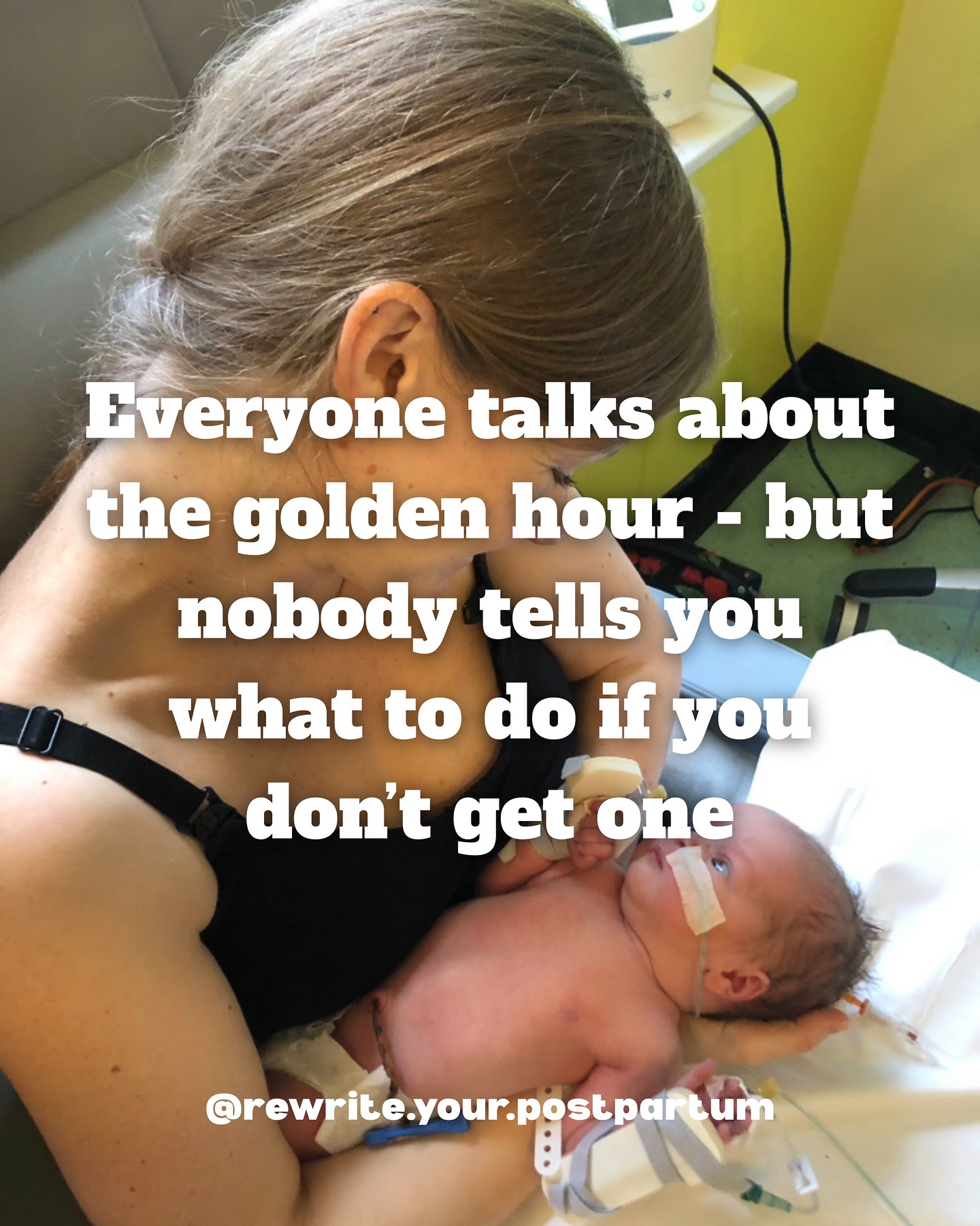 I missed the golden hour with my first baby.
There was no skin-to-skin, no breast crawl. And it was an uphill struggle from there.
For days, I felt like I was failing.
And honestly, if it hadn’t been for one incredible nurse who stayed, listened, and guided me through those first few days, I don’t think I would have breastfed my baby at all.
That support changed everything.
And that’s why I’m so passionate about offering support to YOU.
If you’re pregnant and hoping to breastfeed - but you’re nervous about what challenges you might face - let’s make sure you’re not facing it alone.
💛 I offer breastfeeding support that’s personal, holistic, and totally judgment-free — so you feel confident, reassured, and like you have a real plan if things take a little more time.
DM me to chat about availability, or
book a free connection call via the link in bio.
You deserve to feel calm, prepared, and supported — no matter how your feeding journey starts. 🤍
Katie x
#preparingtobreastfeed #breastfeedingprep #breastfeedingsupport #thirdtrimesterpregnancy #dorsetdoula
