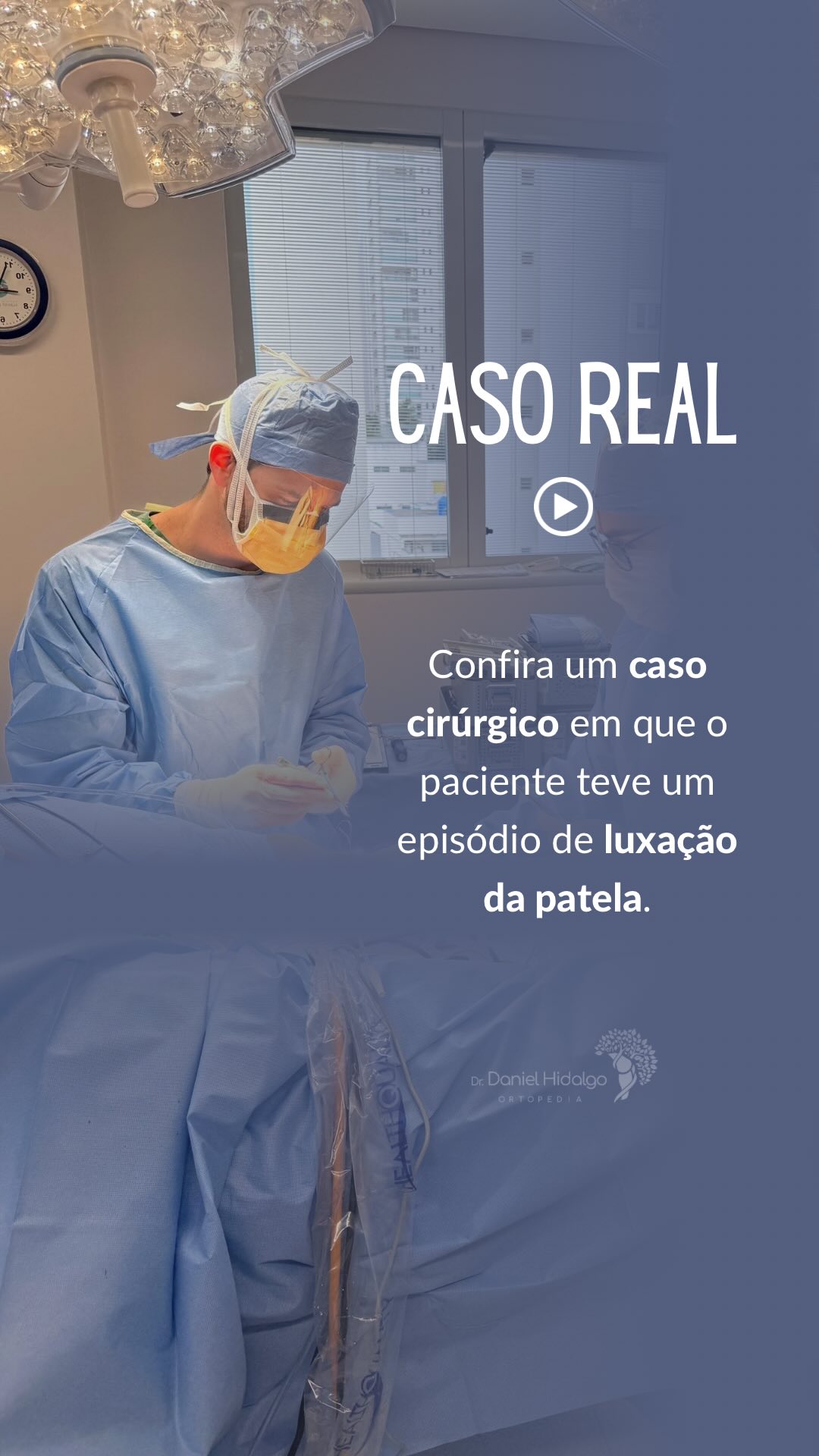 💡Confira o caso cirúrgico de um paciente que teve uma luxação da patela, ou seja, a patela se deslocou para a parte de fora da articulação.
#patela #luxacaopatelar #ligamentopatelofemoralmedial #ortopedia #ortopedista #jardins #klabin #chacaraklabin #altodepinheiros #alphaville #alphavilleearredores
#ortopedia #joelho #cirurgiadojoelho #artroscopia #menisco #ligamentocruzado #dornojoelho
Dr. Daniel Hidalgo - Médico Ortopedista
CRM-SP 137.057 | RQE 41.112
Membro da Sociedade Brasileira de Ortopedia e Traumatologia (SBOT)
Membro da Sociedade Brasileira de Cirurgia do Joelho (SBCJ)