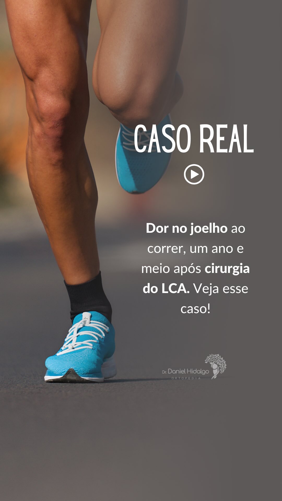 😩Dor no joelho depois da cirurgia do LCA? Veja esse caso real! #joelho #lca