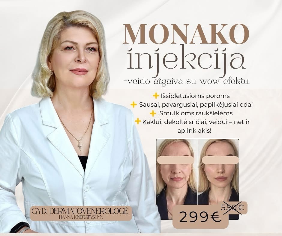 Kviečiame registruotis! ✨ Nuostabūs rezultatai. Procedūra kuriai nereikia reklamos ✨ #rauksliumazinimas #grozioinjekcijos