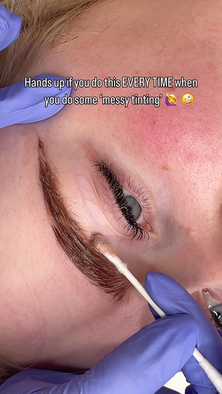 Hands up if you do this too 🙋♀️
Messy tint first to catch every little hair
Then a quick tidy round the edges with a cotton bud
Every. Single. Time. 👌
It’s not always about precision from the start
Sometimes messy = magic ✨
(When followed by mapping or waxing)
This isn’t the only way to tint
But when I do it this way
That clean-up step just has to happen 😅
Are you in the clean-up crew?
Let me know with a 🙋♀️ in the comments!
#browartistuk #browtinting #browtechlife #tintandtidy #browcleanup #beautytherapistuk #browmappingprep #cottonbudmoment #beautyprotips #kingsteigntonbrows #newtonabbotbrows #devonbrowartist