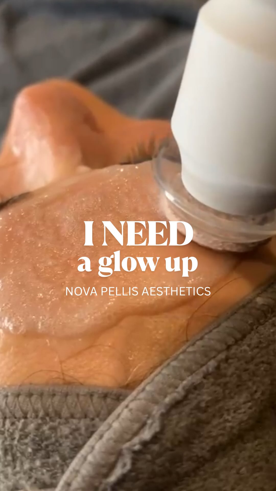 ✨Looking to give your clients a relaxing facial with real results?
Say hello to the Nova Hydra - and one of its most loved features: Oxygenation 💨✨
This innovative treatment draws oxygen into the skin, boosting circulation and promoting cellular renewal. As the capsules react with active ingredients, tiny CO2 bubbles form on the skin-helping to:
✨Improve skin texture
✨Boost radiance
✨Deliver a more youthful, vibrant glow 💫
Its results you can see and your clients will love.
📩Drop us a DM to find out more or book a demo!
🌐www.novapellisaesthetics.com
💌info@novapellisaesthetics.com
📱0800 009 6397
📱WhatsApp 07497 831533
#novahydra #novapellis #skinclinic #facialdevice #glowingskin #oxyfacial #boostincome #training #salonowners #clinicowners #skinhealth #radiofrequency #ems #bespokefacial #facialtreatments