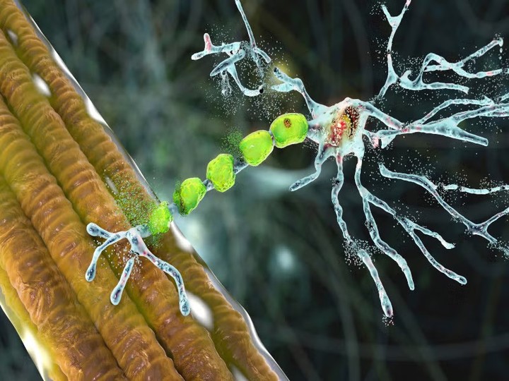 Just one day to go until the NINDS Nonprofit Forum on June 25th! ⏳🎉Today, we’re spotlighting 2023! 🔍
💥 2023: A Breakthrough for ALS Treatment 💥
For those battling Amyotrophic Lateral Sclerosis (ALS), a condition that gradually impairs voluntary movements like walking, talking, and even breathing, 2023 marked a monumental step forward. The FDA approved tofersen (Qalsody), the first-ever treatment for an inherited form of ALS. This precision medicine reduces harmful protein production, offering hope for the ALS community.
And the journey doesn’t stop here! In 2024, NIH, FDA, the Foundation for NIH, and industry partners launched the Accelerating Medicines Partnership® for ALS, aimed at speeding up ALS treatment development — with input from those with lived experience at the forefront. This is just the beginning of a new chapter in ALS care. 🙌
Make sure you follow @americanbrainco to learn more about NINDS and its major milestones! #NINDS75 #ABrainCoProud