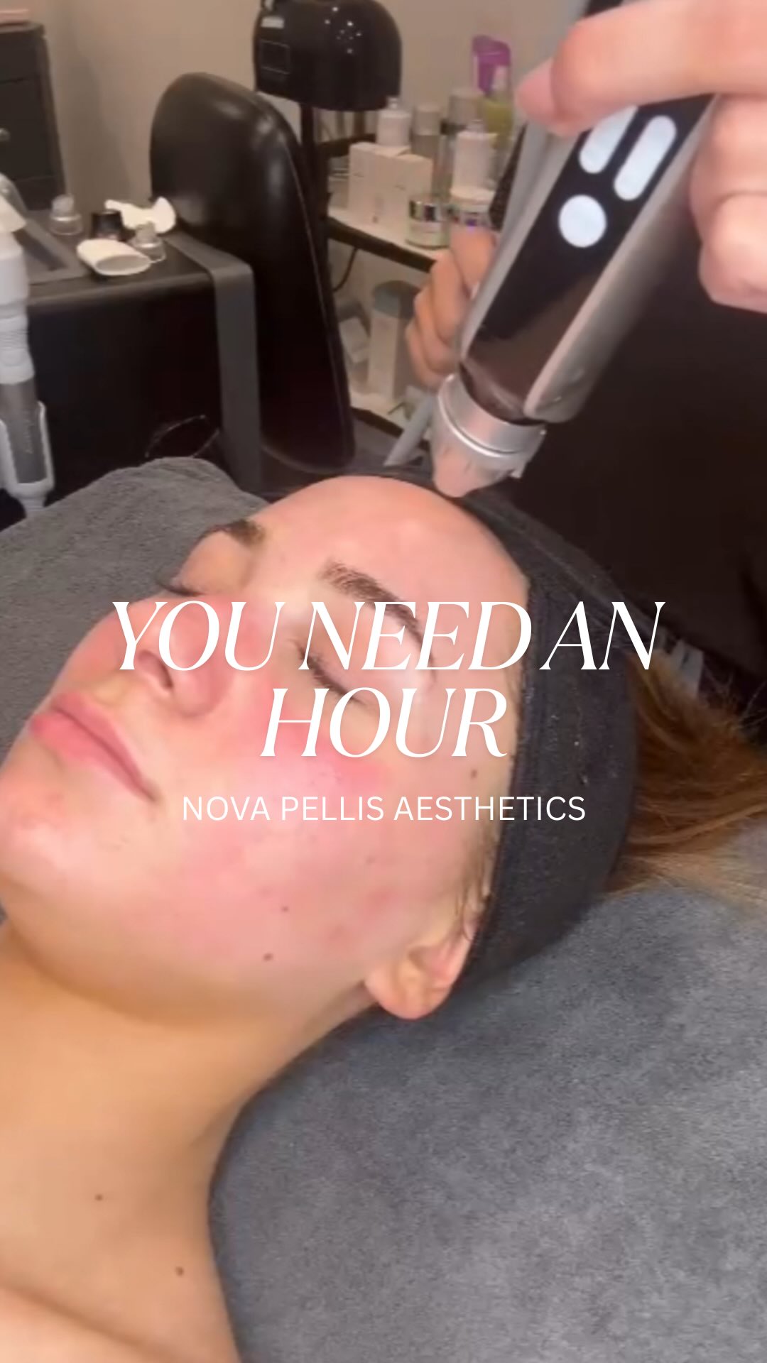 ✨No filter needed… just one hour✨
Give your clients the ultimate facial with Nova Hydra, 10 technologies in one device.
💧Deep Cleanse
✨Deep Exfoliation
💦Deep Hydration
💡Radiofrequency & Micro Lift
Why Nova Hydra?
✔️Fast, results-driven treatment
✔️Glowing skin in just one session
✔️ Minimal downtime, maximum wow
✔️Boost client satisfaction and your revenue
📩Ready to offer next level facials?
📍Get in touch with our team at Nova Pellis Aesthetics.
Drop us a DM or visit our website to book a machine demo.
🌐www.novapellisaesthetics.com
📱0800 009 6397
📱WhatsApp 07947 831533
#novahydra #facialdevice #skintechnology #glowingskin #clientglowup #boostyourbusiness #nofilterglow #salonowners #clinicowners