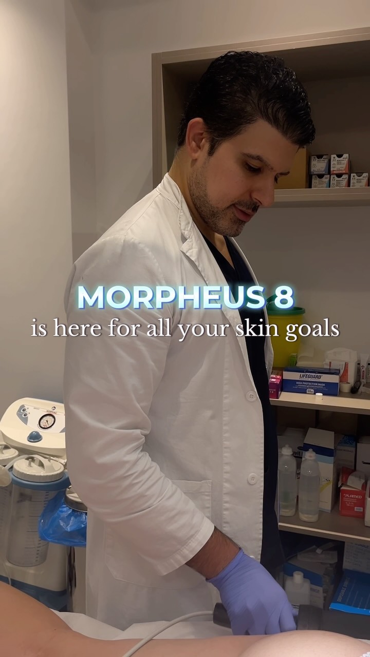 ✨ Morpheus8 is here for all your skin goals
The ultimate treatment to elevate your skin from within:
• Tightens loose, saggy skin
• Boosts deep collagen production
• Smooths texture and tone
• Enhances elasticity—fast
• Refines facial & body contours
From jawline to arms, abdomen and beyond—Morpheus8 delivers sculpted, radiant skin with depth and precision.
✨ Exclusively by @dr.ektor
📲 Book your appointment:
📞 GR: +30 210 725 8982
📞 CY: +357 96 444 870
📧 info@perfect-blue.com
🌐 www.dr-ektor.com
#Morpheus8 #DrEktor #ContourEnhancement #LuxurySkinCare #SkinGoals #CollagenBoost #kolonaki #athens #cyprus #drektor #RadiantSkin #RefinedResults #AestheticExcellence