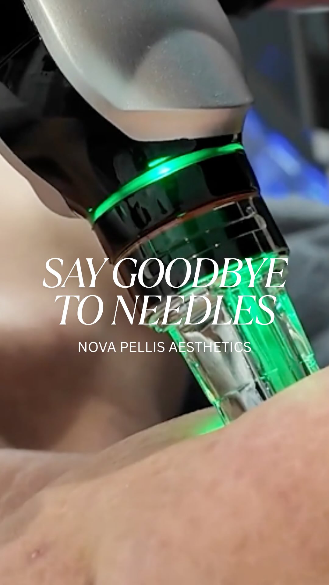 Say goodbye to needles and hello to glowing skin ✨
One of the hand pieces on our Nova Hydra Device-
The EMS Nano Mesotherapy delivers powerful skin loving ingredients deep ingredients deep into your skin, without the pain or downtime.
Using nano pins, RF, EMS, LED technology, this treatment:
☑️Boosts collagen
☑️Smooths fine lines & wrinkles
☑️Lifts & tones facial muscles
☑️Leaves skin radiant & refreshed
100% safe. No needles. No side effects. Just results 🔥
If you are looking for new technology for your clinic or salon, drop us a message or visit our website and book a free demo with one of our trainers.
🌐www.novapellisaesthetics.com
💌info@novapellisaesthetics.com
📱0800 009 6397
📱WhatsApp 07497 831533
#novahydra #novapellis #ems #mesotherapy #facial #clinicowners #salonowners #glowingskin #training #skinhealth #radiofrequency #bespokefacial #newclinic #consumables