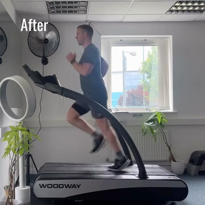 🤩 Meet JAMES! And admire his new running technique after 6 sessions, and a lot of hard work! 💪
When we initially met for James’ Running Technique Assessment in December last year, we discussed his history of knee pain (including ACL repair), hip discomfort and frustration at not being able to run much further than 10km without pain stopping him.
Looking at his running and general movement there were a number of compensations that were inhibiting both his enjoyment of his running and also, importantly, his efficiency.
The main thing we focused on was implementing a strong heel cycle - and hip mobility, glute strength and activation exercises to support it. 6 months later, he’s no longer crossing over and is spending much more time in the air which has greatly reduced the hip drop and increased his core and pelvic stability.
There are still things we can focus and build on as he increases volume and speed, but what an improvement!
HUGE well done James 👏
@therunningschool
@optimalmovement_uk
#runningtechnique #gaitanalysis #runbetter #movebetter #runningcoach #progress #welldone #shrewsbury