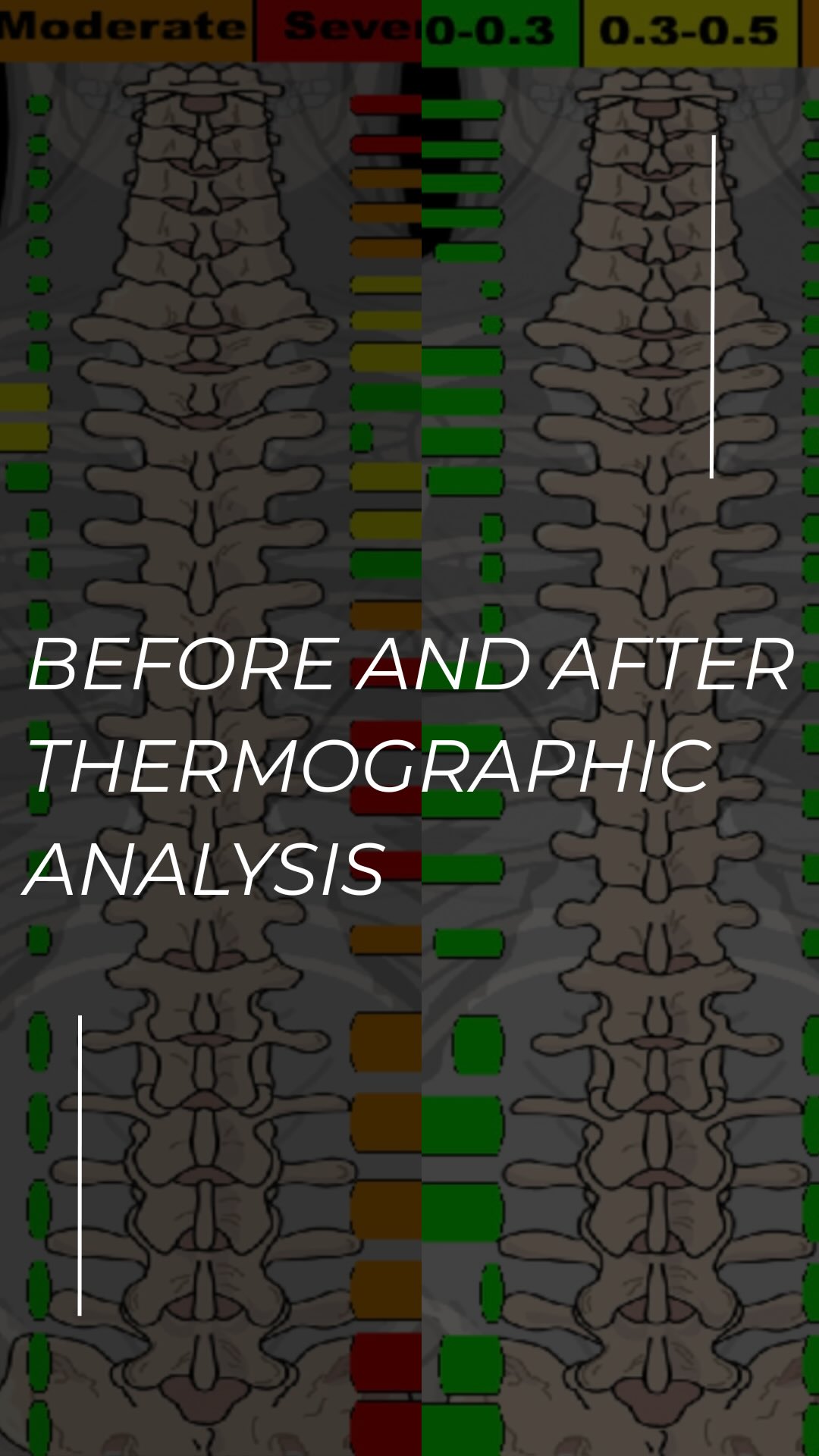 A thermographic scan helps us detect areas of stress and imbalance in your nervous system even before pain shows up.
It’s a non-invasive, powerful tool to personalize your chiropractic care.
¡📲 Ask us how it works at your next visit!
#ThermographicScan #ChiropracticAssessment #NervousSystemHealth #ChiropracticCare #OrlandoChiropractor