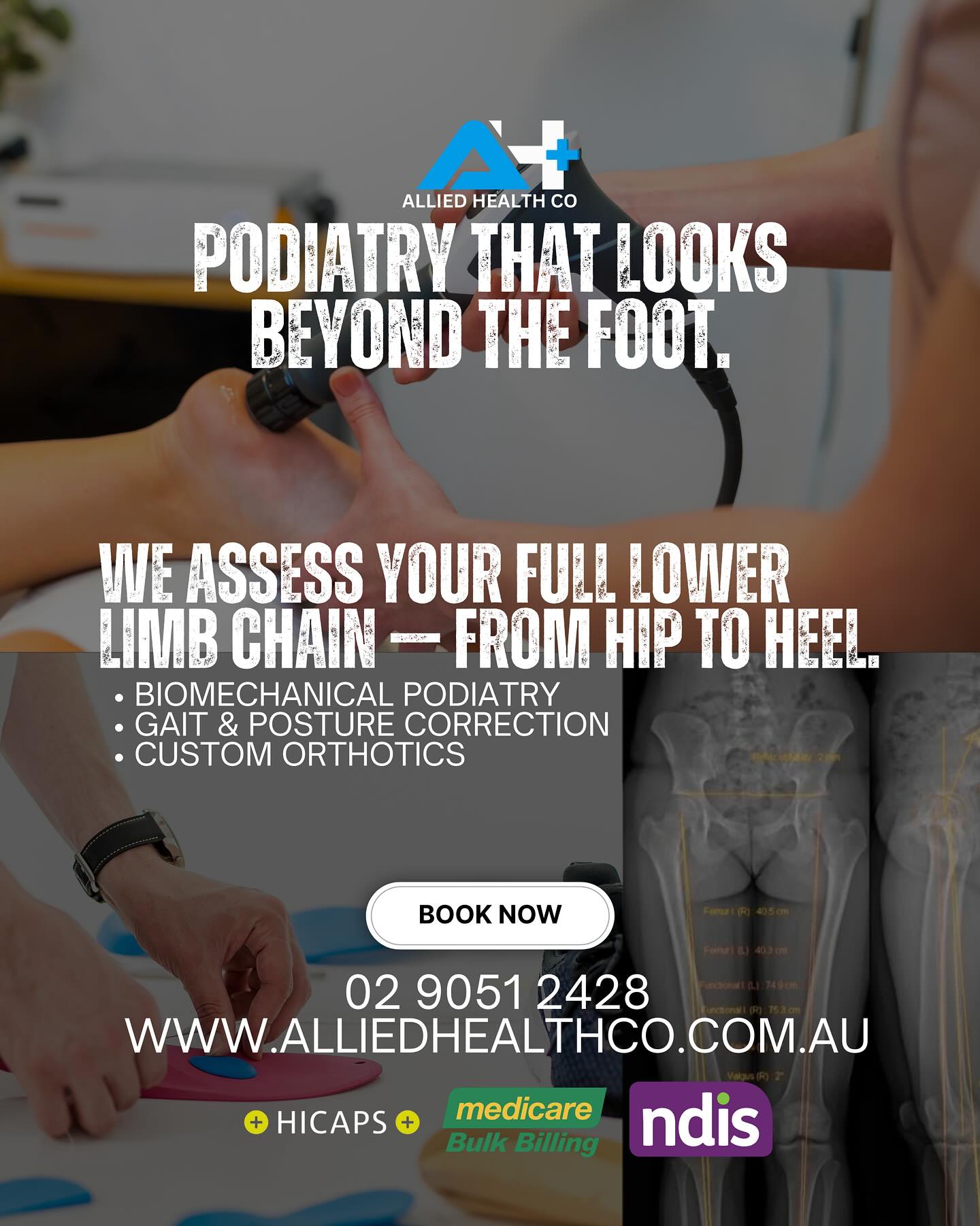 👣 Hip, knee, ankle or foot pain holding you back? It might be more connected than you think.
At Allied Health Co, our expert podiatrists assess the entire lower limb chain — from hip to heel — to uncover the true source of your pain.
✅ Biomechanical Assessments for Kids & Adults
✅ Gait & Posture Correction
✅ Custom-Made Orthotics for Sport & Daily Life
📍 Located in Gregory Hills
📞 Call 02 9051 2428 or visit alliedhealthco.com.au to book now!
💥 HICAPS | Medicare Bulk Billing | NDIS Approved
#Podiatry #Biomechanics #GaitAnalysis #CustomOrthotics #GregoryHills #AlliedHealthCo #FootPain #KneePain #HipPain #SportsPodiatry #NDISprovider #PainFreeLiving #LowerLimbCare