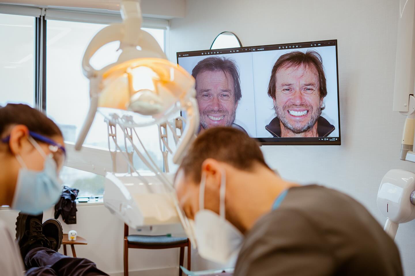 Antes de avançarmos com um tratamento de reabilitação oral complexo, é essencial garantir que tanto o paciente como a equipa clínica estejam alinhados quanto ao resultado final.
Nas imagens, partilho convosco uma fase fundamental de um caso de reabilitação total com coroas e facetas: a simulação do sorriso através de um mock-up acrílico. Esta ferramenta permite-nos:
🔹 Antecipar com realismo o resultado estético pretendido;
🔹 Avaliar proporções, simetria e harmonia facial com o paciente presente;
🔹 Ajustar pormenores no planeamento antes de qualquer intervenção definitiva;
🔹 Envolver o paciente no processo e ajudá-lo a visualizar o impacto do tratamento no seu rosto e na sua confiança.
Com o apoio da tecnologia digital e de uma abordagem centrada no detalhe, conseguimos planear sorrisos que respeitam a individualidade de cada pessoa — funcionais, naturais e duradouros. 🙌
—————————————————————————————
Before moving forward with a complex oral rehabilitation treatment, it’s essential to ensure that both the patient and the clinical team are fully aligned on the final result.
In these images, I’m sharing a key phase of a full-mouth rehabilitation case with crowns and veneers: the smile simulation using an acrylic mock-up. This tool allows us to:
🔹 Realistically anticipate the intended aesthetic outcome;
🔹 Assess proportions, symmetry, and facial harmony with the patient present;
🔹 Fine-tune the planning before any definitive intervention;
🔹 Involve the patient in the process and help them visualize the impact of the treatment on their face and self-confidence.
With the support of digital technology and a detail-oriented approach, we’re able to design smiles that respect each person’s individuality — functional, natural, and long-lasting. 🙌
#oralrehabilitation #ceramiccrown #veneer #aestheticdentistry #mockupdental #maloclinic