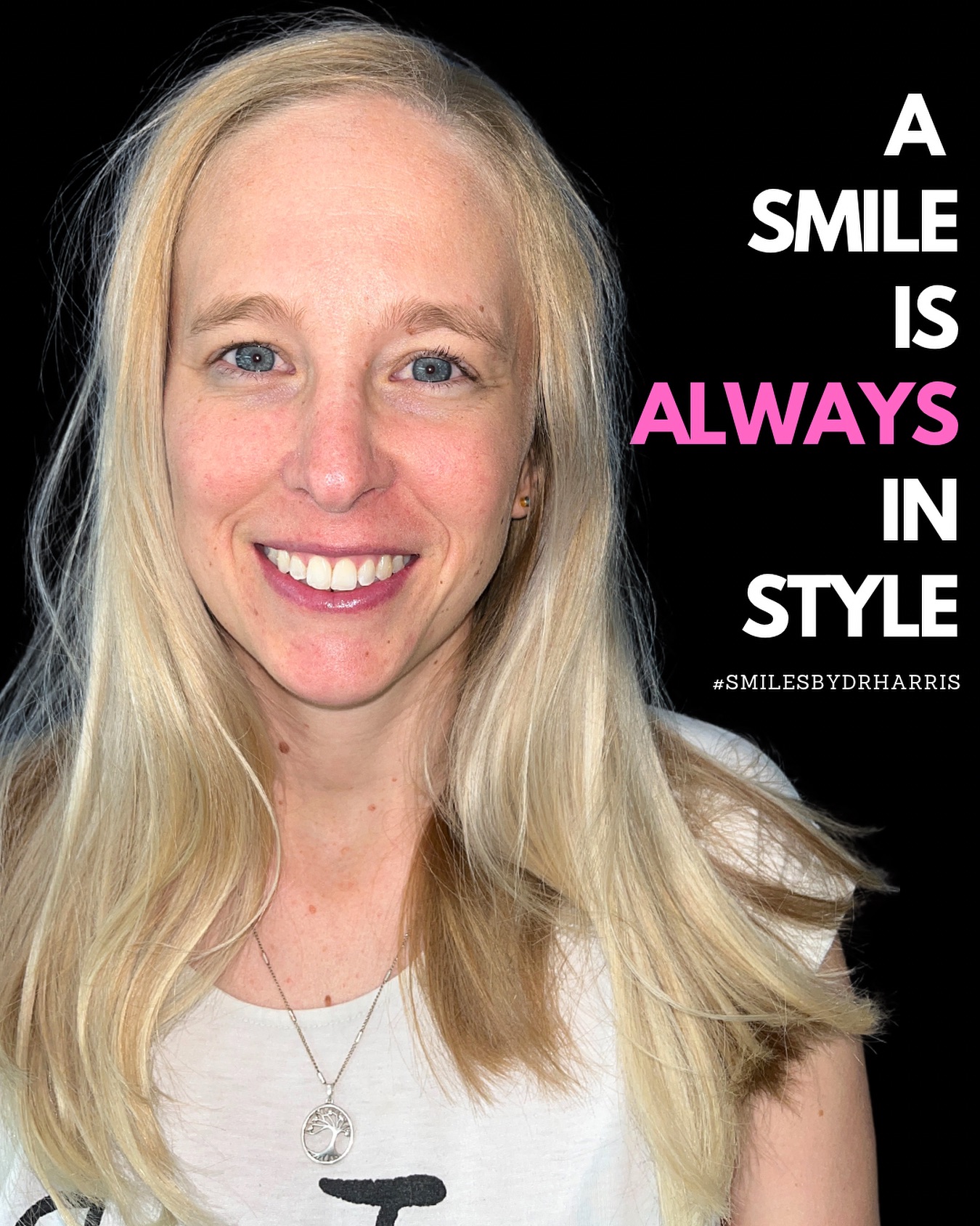 From Crooked to Flawless - Grab our Aligners + Whitening package now!
#smile #smiledesign #teethwhitening #cosmeticdentist #dentistindelhi #fyp #virelpost #smiletransformation #aestheticdentistry