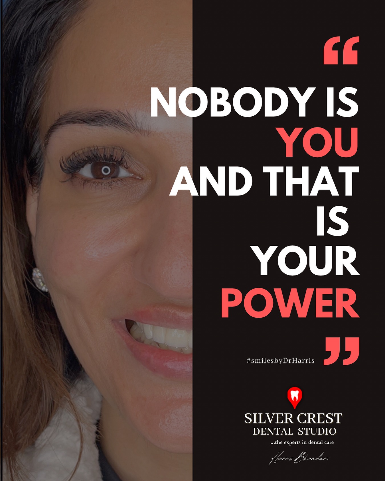 The Perfect Pair: Aligners for the Shift, Veneers for the Shine. ✨
#smiledesign #smile #smiletransformation #dentistindelhi #confidence #cosmeticdentist #craftingsmiles #veneers