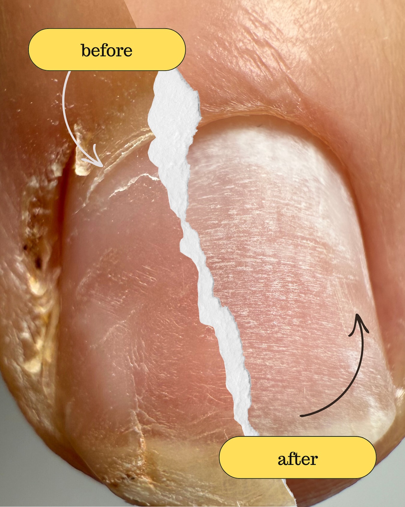 Les avants / après me surprendrons toujours ! Cette sensation de satisfaction qu’on obtient avec ce genre de résultat 😍
🚨 Dîtes moi que je ne suis pas la seule ?
#manucure #manucurerusse #manucurecombinee #avantaprès #naturalnail