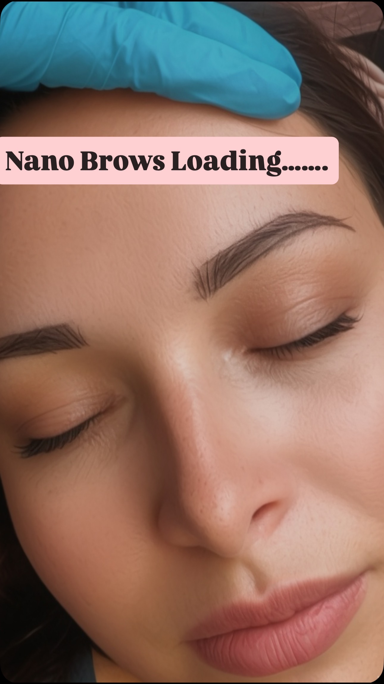 ✨ NANO BROWS — MACHINE-PERFECTED HAIR STROKES ✨
Say hello to your dream brows 🙌🏼 This stunning set is a combination nano brow:
✔️ Machine hair strokes in the front for a soft, natural look
✔️ Shaded tail for definition and long-lasting shape
💡 Why choose machine nano strokes?
Unlike microblading, nano brows use a machine to gently implant pigment, making them ideal for most skin types — especially oily, textured, or mature skin. The added soft shading in the tail gives better pigment retention, structure, and results that last for years with proper care.
💧 Combo brows = the best of both worlds: natural AND defined.
🧖♀️ Perfect for:
✔️ Oily skin
✔️ Those who want longer-lasting brows
✔️ Anyone tired of filling in sparse tails daily
🗣️You can do this as a first time client or an existing client at your annual touchups @an.arch.above