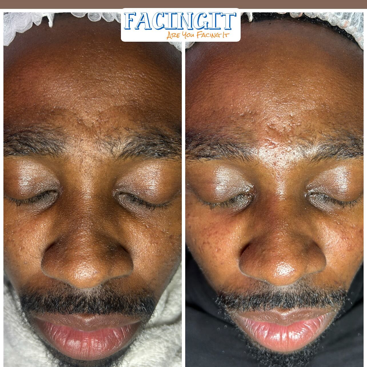 #Atlanta #AtlantaLife #AtlantaFood #AtlantaEats #AtlantaNights #AtlantaStyle #AtlantaArt #AtlantaPhotos #AtlantaPhotography #AtlantaStreets #AtlantaTimes #AtlantaLiving #AtlantaLifestyle #AtlantaMoments #AtlantaLove #PeopleOfAtlanta #AtlantaFashion #AtlantaMusic #AtlantaNightlife #AtlantaDaily #AtlantaFitness #AtlantaFit #AtlantaInfluencer
#AtlantaBlog #AtlantaShopping #AtlantaRestaurants #AtlantaFoodie #AtlantaAdventures #AtlantaVibes #AtlantaHomes