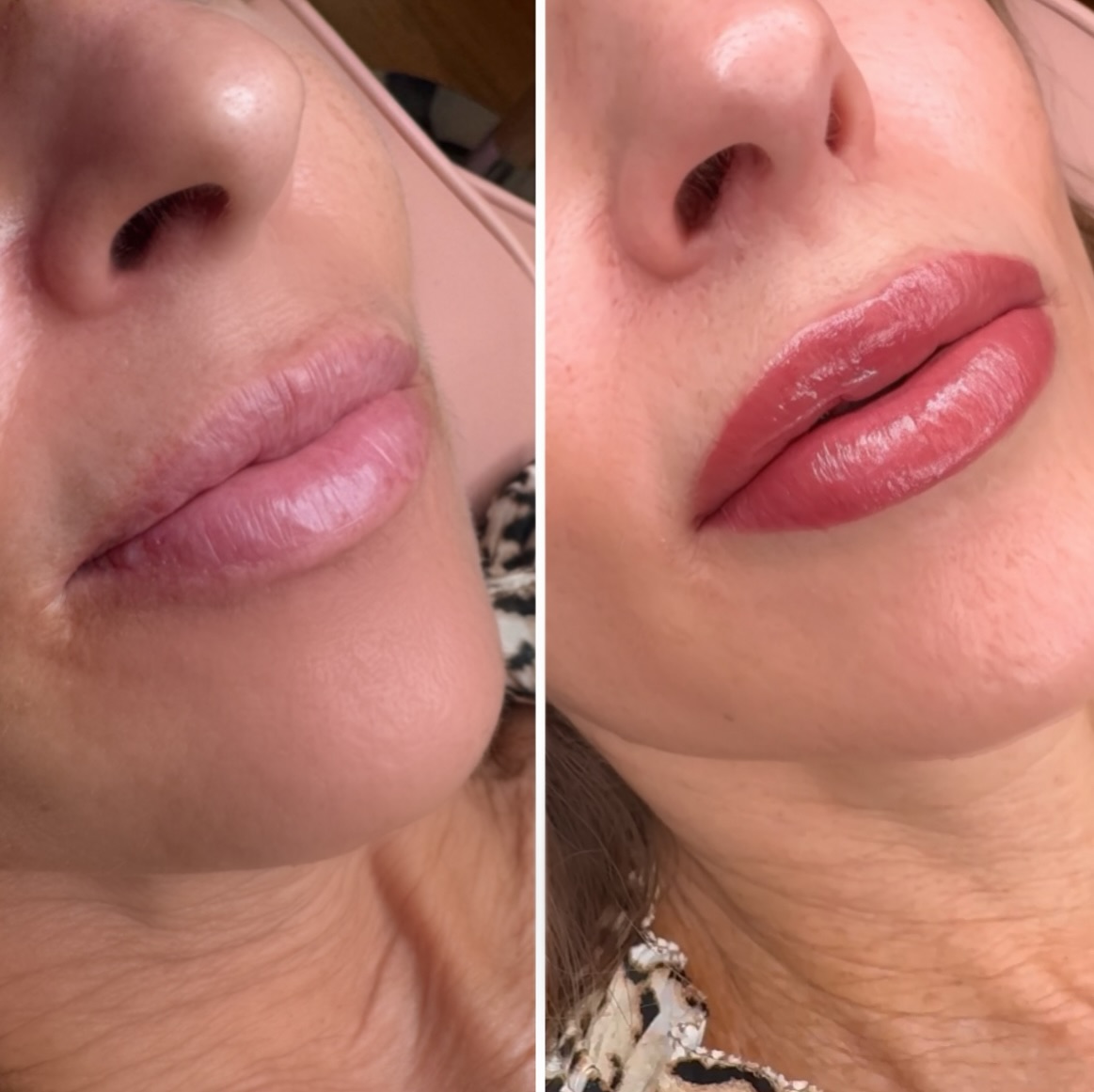 Ever feel like your face looks… washed out? 😩
Like your lips, brows, and eyes are all blending into the same shade of “meh”?
That’s where Lip Blush comes in.
It adds that soft tint of color to your lips—nothing crazy, just enough to wake up your whole face 👄✨
Suddenly your lips match your vibe, your brows aren’t doing all the work, and your eyes pop without trying.
You look alive. Fresh. Balanced. Not faded.
Just naturally pretty, even when you’re bare-faced.
Heals 20-40% lighter than photo to give you a soft, natural color that look like it was bitten with color!
Complimentary consultations ! Come in and let’s try on some colors and talk all things #LipBlush
I can achieve your perfect nude shade or mimic your favorite lipstick you use daily. From natural to bold I gotchuuuuuu
💋xoxo @an.arch.above