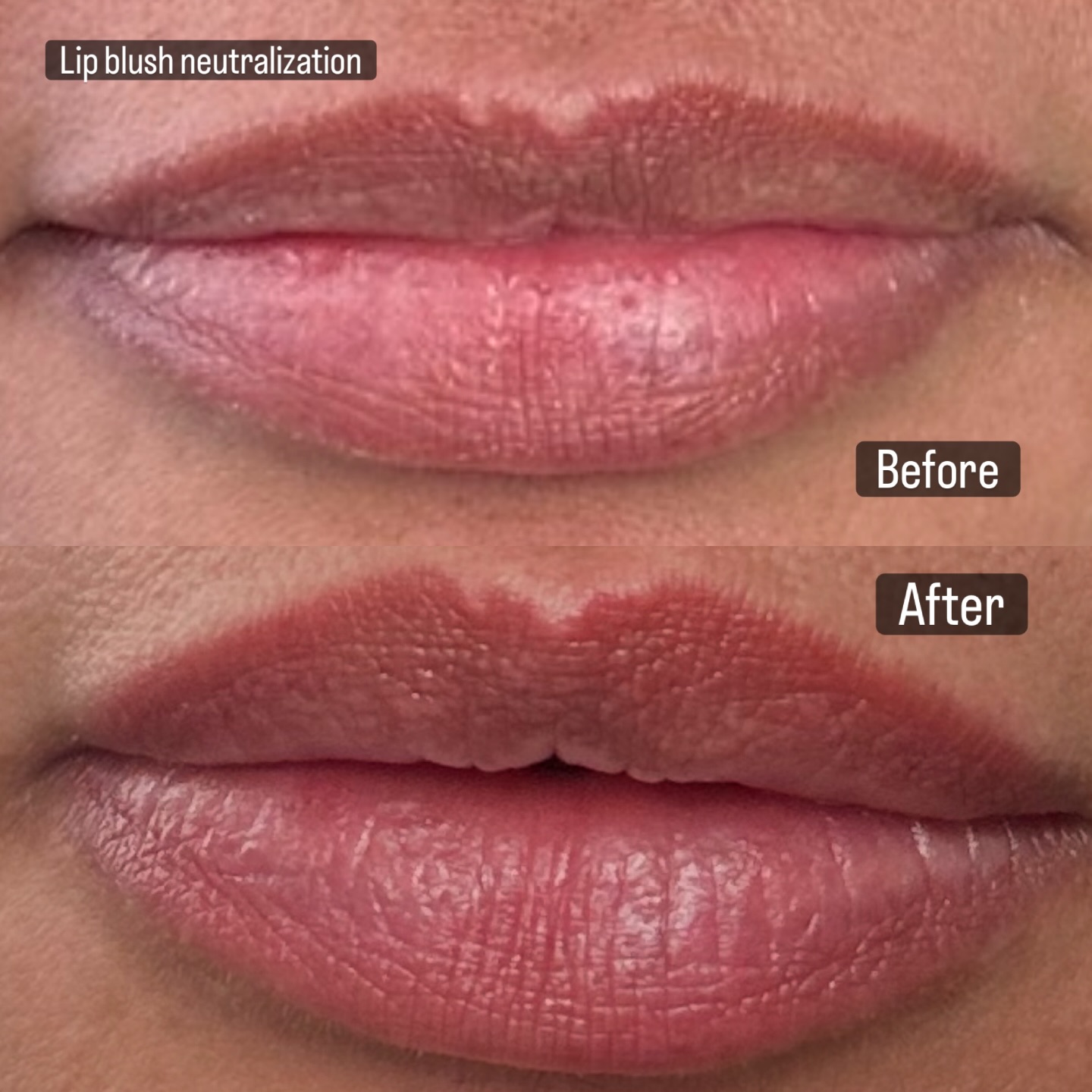 Like lip blush lip neutralization works to bring out a pinker pout and mask the natural color of highly pigmented lips. This is what was achieved after 2 sessions, we plan to do 1 more to brighten the lips even more. I love that her lips look so natural AND full!
Lip blush, dark lip neutralization, permanent cosmetics, San Mateo, San Mateo brows, San Mateo moms, San Mateo tattoo, private tattoo studio