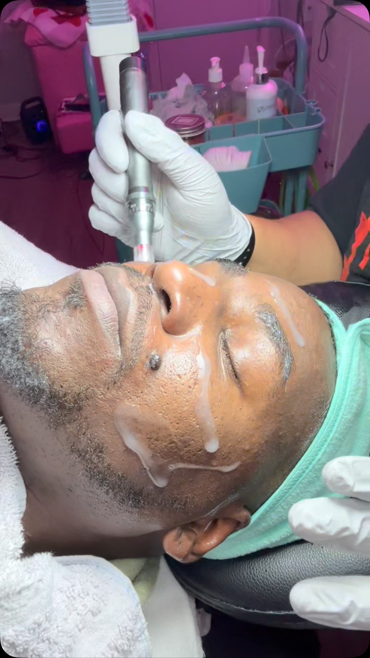 Microneedling is a minimally invasive procedure for your skin. Your healthcare provider uses thin needles to make tiny holes in the top layer of your skin. The damage helps stimulate your skin’s healing process, so it produces more collagen and elastin. These proteins keep your skin firm and smooth. #facials #bodysculpting #georgiastate #postoptreatment #atlanta #laserlipo #skincare #bodygoals #cavitation #noninvasive #cardib #lipo #atlesthetician #nonplasticsurgery #cellulite #coolsculpting #atlantafacials #woodtherapy #facialsatlanta #atlesthetician #facialatlanta #fyp #nonsurgical #vacuumtherapy #lymphaticdrainage #atlanta #explorepage #postop #foryoupage #bodycontouringatlanta
#atlfacials #foryoupage #fyp #atlesthetician
Fun Facts👉🏽 “each inch of skin is made up of 19 million skin cells, 650 sweat glands, 20 blood vessels, and 1,000 nerve endings, according to the” American Academy of Dermatology (AAD). Who wouldn’t knew 🧐 The cleansing of the skin is one of the most important benefits of the facial. Face massages and facials will help you accelerate the cell regeneration process. It will also increase the production of collagen under your skin. It will help you get younger skin and reduce the signs of stress. Follow my Ig➡️ @_FacingIt
Hey yal wassup check out some of my reviews. My goal is to help you achieve your healthy skin care. Red bumps, acne, dark spots, dead skin, rough skin , dry skin, extractions, black heads exc. can clog up pours. Let me help treat your face to your desire look. Are You FacingIT