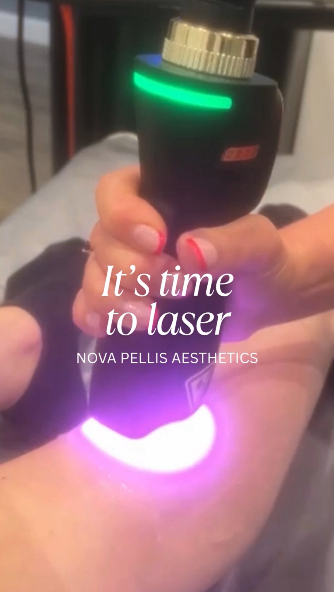 ⚡️Introducing the Most Advanced Diode Laser - NOVA LASE PRO⚡️
Built for professionals who demand the best, NOVA LASE PRO, combines cutting-edge German engineering, intelligent AI technology, and ergonomic design to deliver the future of effortless, effective, and elegant hair removal.
This powerful device is designed to provide outstanding results with maximum comfort, helping clinics offer fast, safe, and highly effective treatments for clients of all skin types.
Advanced training is provided with a core of knowledge assessment to be undertaken by qualified therapists.
📩Get in touch with us at Nova Pellis Aesthetics to have a chat or book a demo and discover how NOVA LASE PRO can elevate your clinics treatment menu.
🌐www.novapellisaesthetics.com
💌info@novapellisaesthetics.com
📱0800 009 6397
📱WhatsApp 07497 831533
#novalasepro #laserhairemoval #diodelaser #aesthetictechnology #skinconfidence #hairfreesolutions #advancedaesthetics #clinicowners #novapellis #getintouch #laser