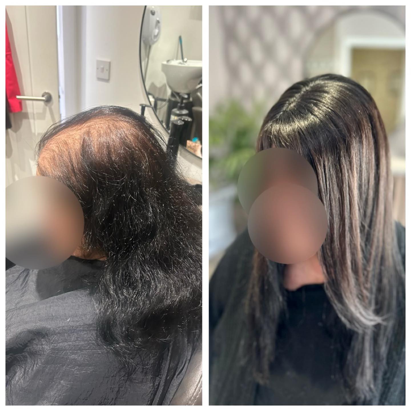 Every now and then I meet the most interesting and beautiful people. ❤️
What a pleasure it was getting to know this lady. Here’s her before and after pics
.
.
.
#lacetopwigs #lacefrontwigs #lacewigs #wigs #lacefrontal #alopecia #areata #hairloss #hairreplacements #bespokewigs #customcolouredwigs #handmadewigs #wigbuilding #hairintegration #laceintegration #hairextensions #weave #hairlossspecialist #trichologist #trichology #hairlosssolution #hairlosssalon #hair #fphl