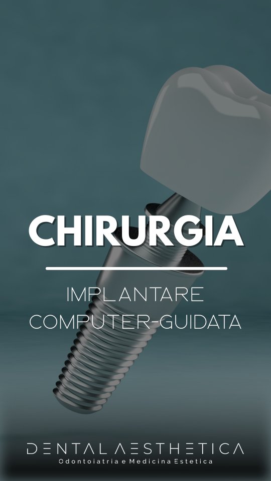 🔩 Impianto dentale senza incisioni con il bisturi e senza applicare punti di sutura.
Se stai cercando una soluzione poco invasiva per ripristinare l'estetica del tuo sorriso o la funzionalità masticatoria della tua bocca ma vuoi evitare stress post chirurgico e dolore, l'implantologia computer guidata è la soluzione adatta a te.
Vantaggi:
✅️ Massima precisione chirurgica
✅️ Minor dolore e stress post operatorio
✅️ Nessuna incisione con il bisturi né punti di sutura
✅️ Tempi
Prenota ora la tua consulenza specialistica
Dental Aesthetica
📍 viale della Grande Muraglia 256/258
📱 375 88 47 069
#dentista #dentistaroma #Implantologia #roma