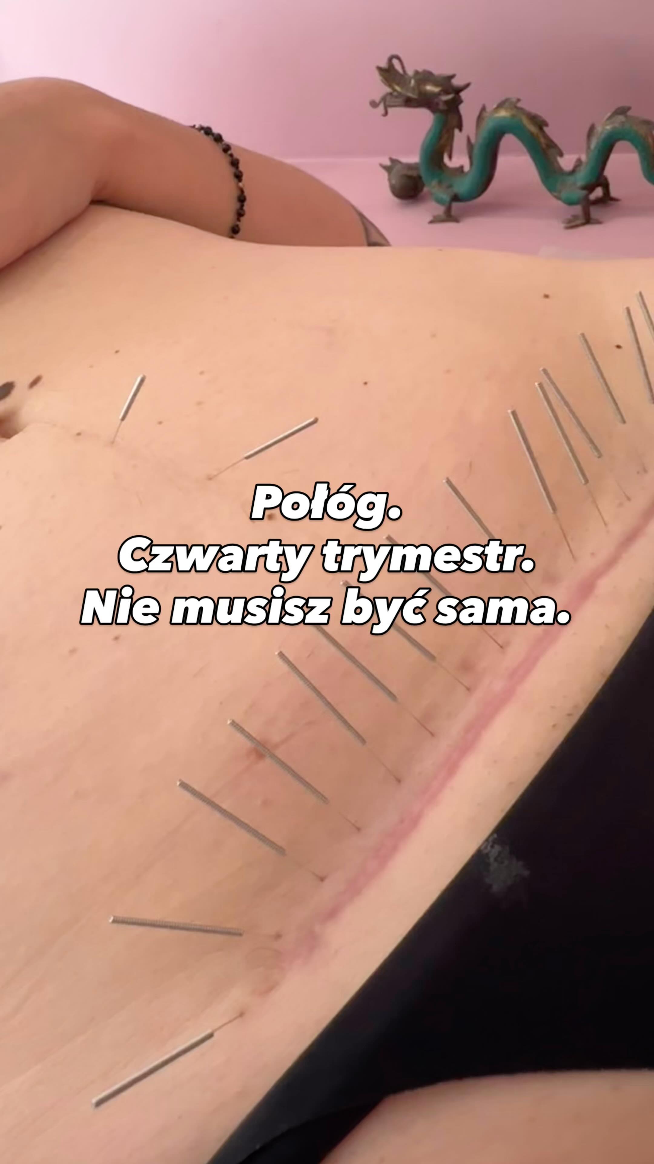 ✨ Odwiedziła mnie cudowna @chce_bycmama z Leosiem 🦁 Słodkim uśmiechem, którym mnie obdarował, zapewnił, że pamięta ciocię od igiełek, gdy był jeszcze w brzuszku ❤️
✨Połóg to nie tylko regeneracja fizyczna. To czas, kiedy ciało i emocje potrzebują troski.
Akupunkturą wspierzesz w 4. trymestrze:
🌿 baby bluesa, równowagę emocjonalną,
🌿 gojenie blizny po cesarskim cięciu,
🌿 laktację,
🌿 inne objawy, które Twój organizm zgłasza,
🌿 równowagę u maluszka m.in. w regulacji wypróżnień.
Nie musisz przechodzić przez to sama – umów się na wizytę i zadbaj o siebie w tym wyjątkowym czasie.
📩 Napisz wiadomość lub odwiedź @berthaholistic, by rozpocząć terapię.
Zaopiekuj się sobą w Bertha Holistic.
•••••••••••••••••••••••••••••••••••••••••••••••••••
🌱 Wsparcie płodności, zdrowia, emocji, urody.
🌸 Beata Szlachta – ekspert medycyny chińskiej
❤️ Bertha Holistic Centrum medycyny naturalnej we Wrocławiu.
☘️ Akupunktura, zioła, medycyna chińska, terapie twarzy.
•••••••••••••••••••••••••••••••••••••••••••••••••••
#akupunktura #wrocław #ziołolecznictwo #medycynachińska #TCM #zdrowie #niepłodność #płodność #ivf #invitro #ciąża #zdrowiekobiety
#połóg #czwartytrymestr #mamawpołogu #cesarskiecięcie #bliznapocc #noworodek #regeneracjapoporodzie #naturalnewsparcie #laktacja #akupunkturawpołogu