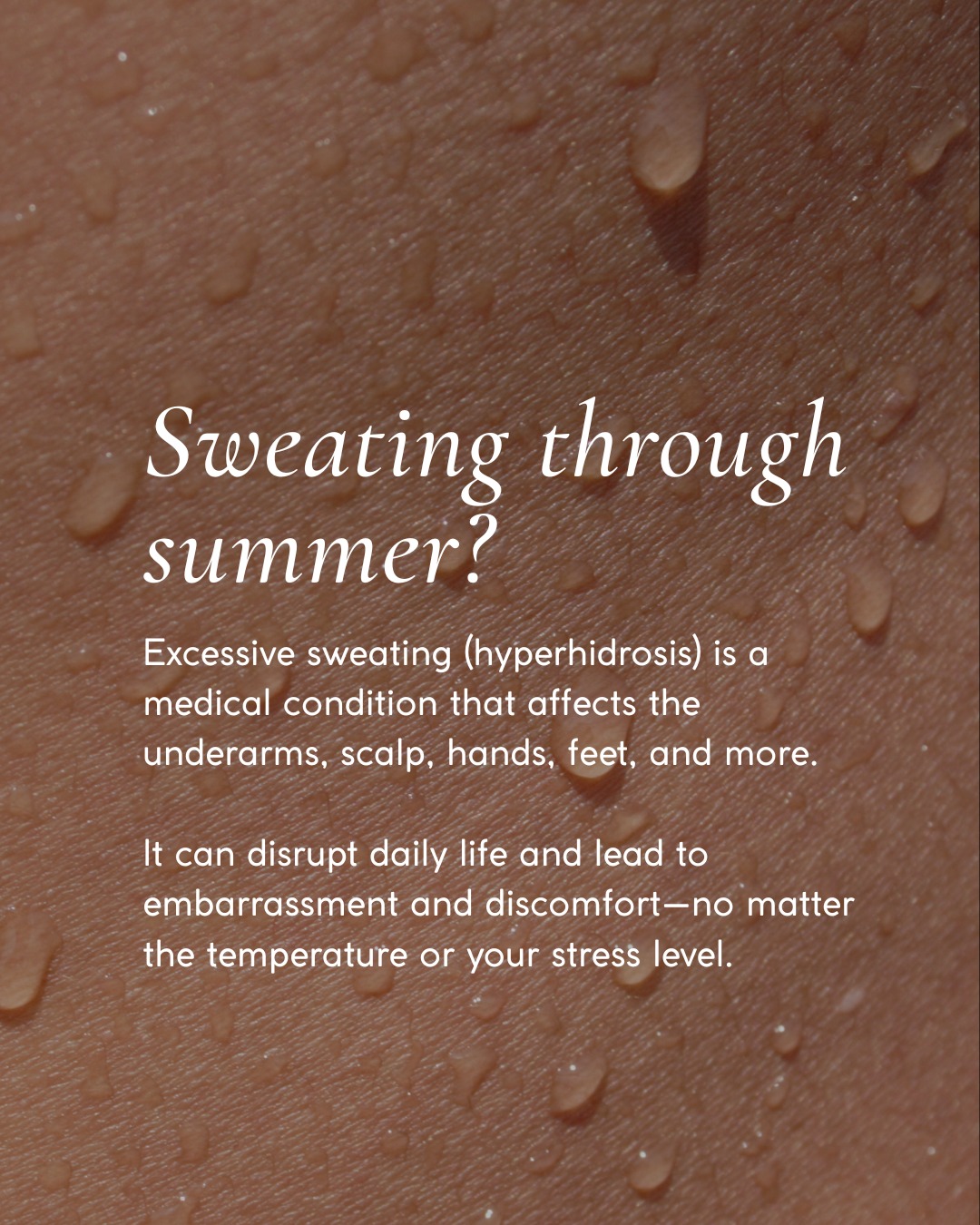 Most cases of hyperhidrosis occur in people who are otherwise healthy. Heat and emotions may trigger it in some, but many who suffer from it sweat nearly all the time, regardless of their mood or the temperature.
Botox® Therapeutic targets sweat glands to significantly reduce sweating in treated areas like the underarms, scalp, hands, or feet. One of our patients, Natalie, struggled for years until she found relief through treatment by Dr. Ray. Now, she feels confident wearing what she wants — no matter the season!
If you’re ready to stop planning your wardrobe (and your day) around excessive sweat, book a consultation today.
#HyperhidrosisTreatment #ViewLaser #TherapeuticBotox #VancouverAesthetics
#MedicalAesthetics