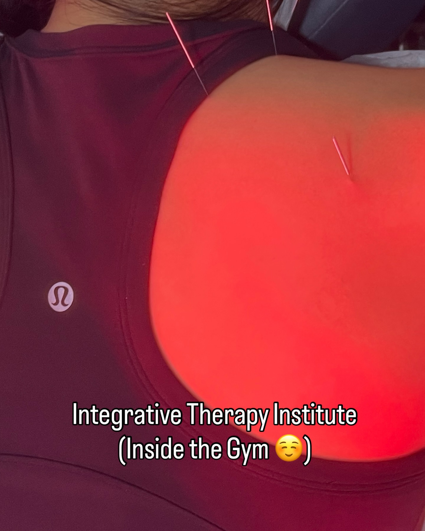 Did you know? đ§ââď¸ Inside our gym, weâve got a wellness clinic that offers acupuncture and chiropractic care â and yes, we take insurance! đââď¸ Whether youâre recovering from an injury or just need a tune-up, weâve got your back (literally).
đ Stop by the front desk to learn more or book an appointment!