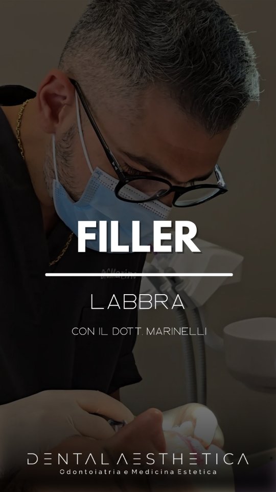 Labbra effetto naturale.
Niente stravolgimenti, sono ridefinizione dei profili e il giusto volume.
🧑🏻⚕️ @doc_claudiomarinelli
💧 @teoxane_italia
Dental Aesthetica - Odontoiatria e Medicina Estetica
📍 viale della Grande Muraglia
📱 375 88 47 069
#labbra #filler #lipfiller #fillerlabbra #medicinaestetica