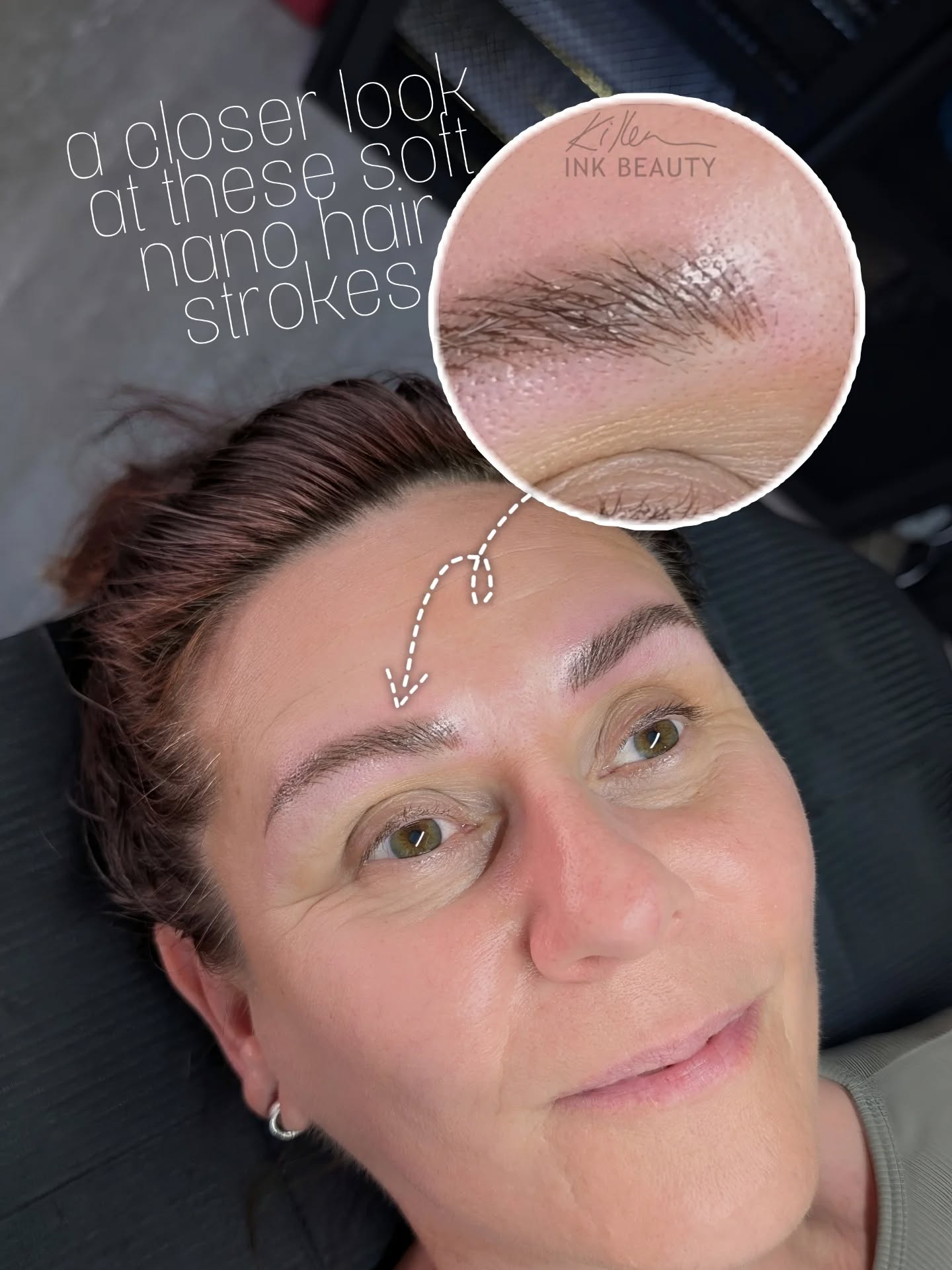 Bringing these barely-there, faded brow tattoos back to life with soft, natural texture. ✨
It’s wild what a little detail can do—these nano strokes make all the difference. 🙌
#CalgaryMicroblading #CalgaryNanoBrows #NanoBrowsCalgary #MicrobladingCalgary #CalgaryBrows #BrowTransformation #NaturalBrows #BrowTouchUp #NanoStrokes #BrowGoals #YYCBeauty #YYCBrows