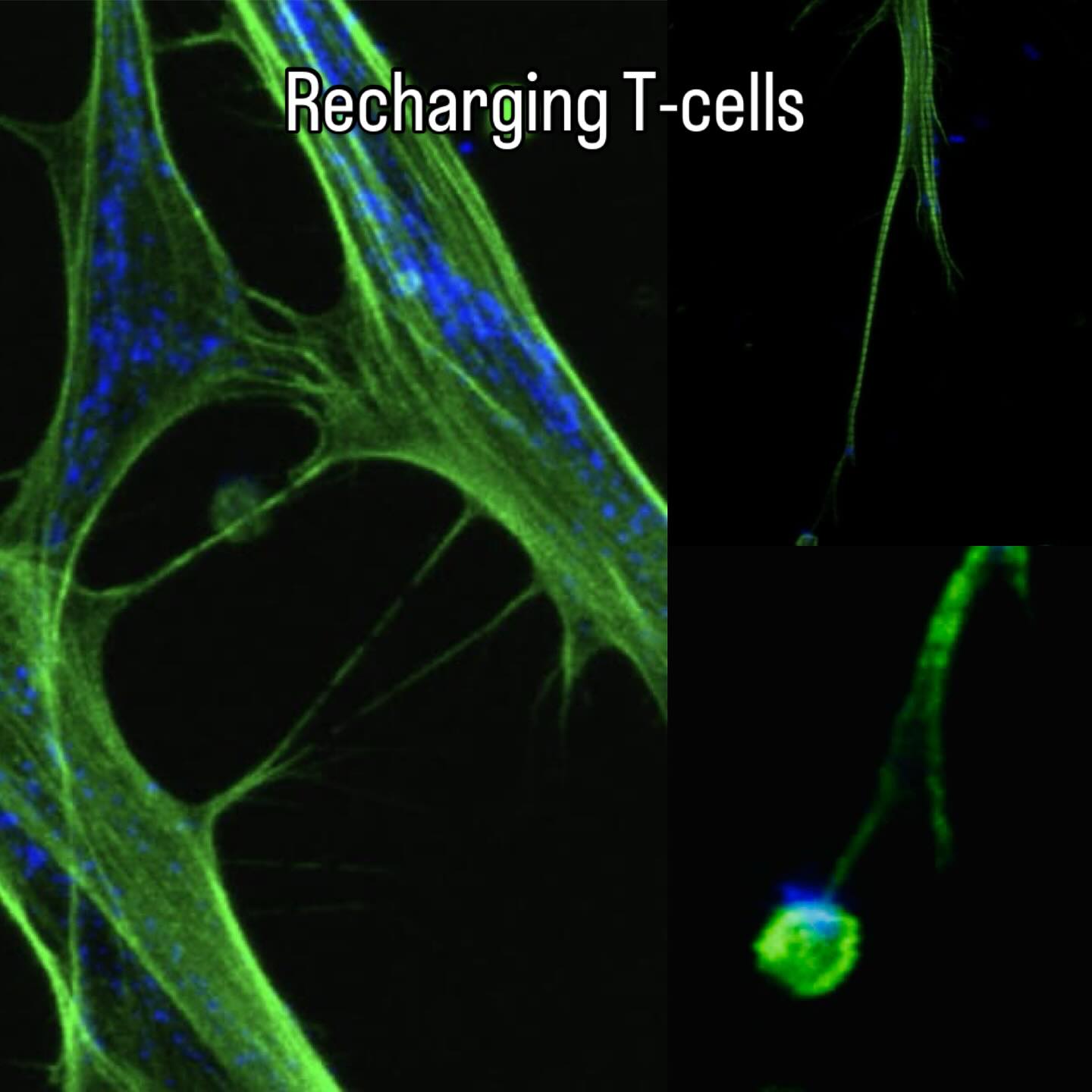 “Intercellular transfer of mitochondria via tunneling nanotubes.” Bone marrow derived stem cells can be seen transferring mitochondria (blue) to CD8+ activated T-cells (green), essentially energizing them. Imaged with a confocal microscope, TNT’s are seen extended from the cytoskeleton (green) of the stem cells. Awesome work lead by @asmakhalilll @shazasquared