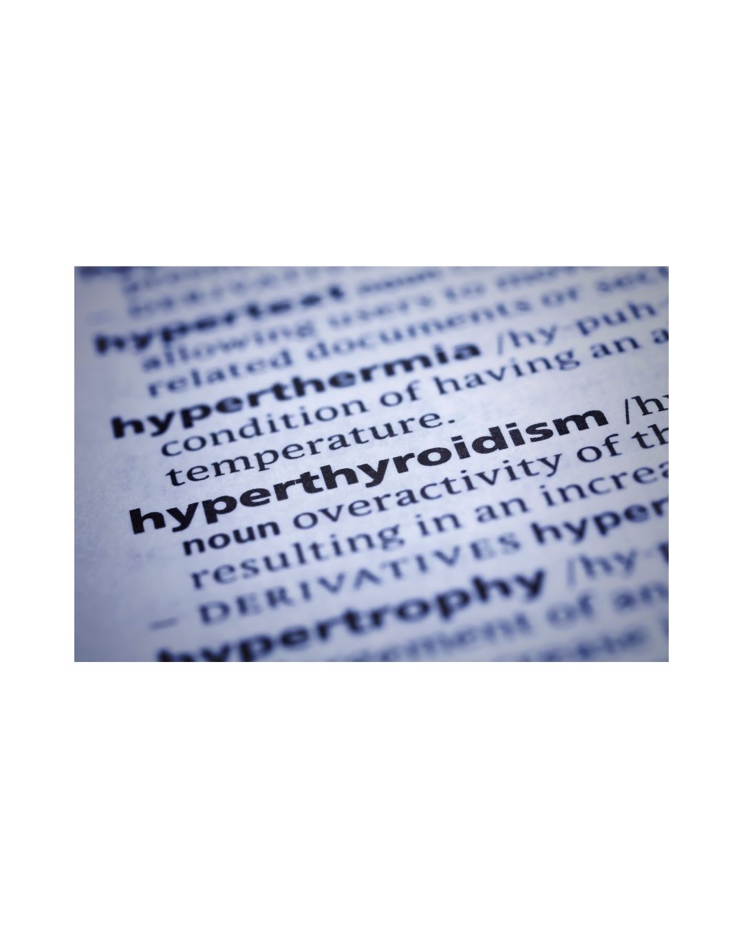 Hyperthyroidism, or an overactive thyroid, can significantly impact the digestive system, primarily causing increased bowel motility and leading to diarrhea or frequent bowel movements. This is due to the thyroid hormones accelerating the digestive process. Other potential digestive issues include malabsorption, abdominal pain, and weight loss despite increased appetite. Hyperthyroidism, particularly Grave’s disease (autoimmune), significantly increases the risk of developing celiac disease (5-fold). It can lead to diarrhea and malabsorption. This is why doing a gluten elimination is so important when you have autoimmune thyroid disease, as gluten significantly damages the mucosal integrity of the intestines in celiac disease.
For individuals with celiac disease, gluten triggers an immune response that damages the small intestine, hindering nutrient absorption. This damage can lead to various symptoms, including digestive issues, fatigue, and in severe cases, long-term health problems. Following a strict gluten-free diet is the only way to manage celiac disease and prevent further damage.