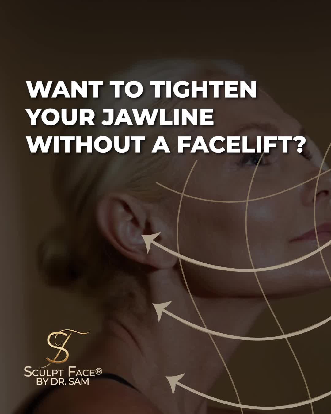Remarkable results in skin tightening.
Endolift® at Sculpt Face® is a minimally invasive, advanced medical laser procedure.
Dr. Sam considers Endolift® as a surgical tool handled with care and intention.
It's an excellent alternative to invasive facelift surgery.
In just one session, Endolift® works from beneath the skin to improve key areas of the face.
🔹 Lifts and defines the jawline
🔹 Tightens sagging neck skin
🔹 Improves skin quality for a youthful complexion.
At Sculpt Face®, Endolift® is adapted to the natural structure of the face and the skin’s unique needs using the Sculpt Face Protocol™:
A surgical approach to non-surgical rejuvenation
by 𝓓𝓻. 𝓢𝓪𝓶 𝔁
Book a consultation and discover the Sculpt Face Protocol™.
It's time to elevate your glow.
#SculptFace
#SculptFaceProtocol
#EndoliftUK
#endolift
#endoliftlaser
#endolifting
#endolifttreatment
#endoliftingfacial
#NonSurgicalFacelifts
#SkinRejuvenation
#SkinGoals
#GlowFromWithin
#CollagenBoost
#SkinTightening
#SkinTighteningTreatment
#facialrejuvenation
#laserrejuvenation
#nonsurgical
#aesthetictreatments
#liverpoolaestheticsclinic
#manchesteraestheticsclinic
#leedsaestheticsclinic
#sheffieldaestheticsclinic
#greatermanchesteraesthetics
#cheshireaestheticsclinic