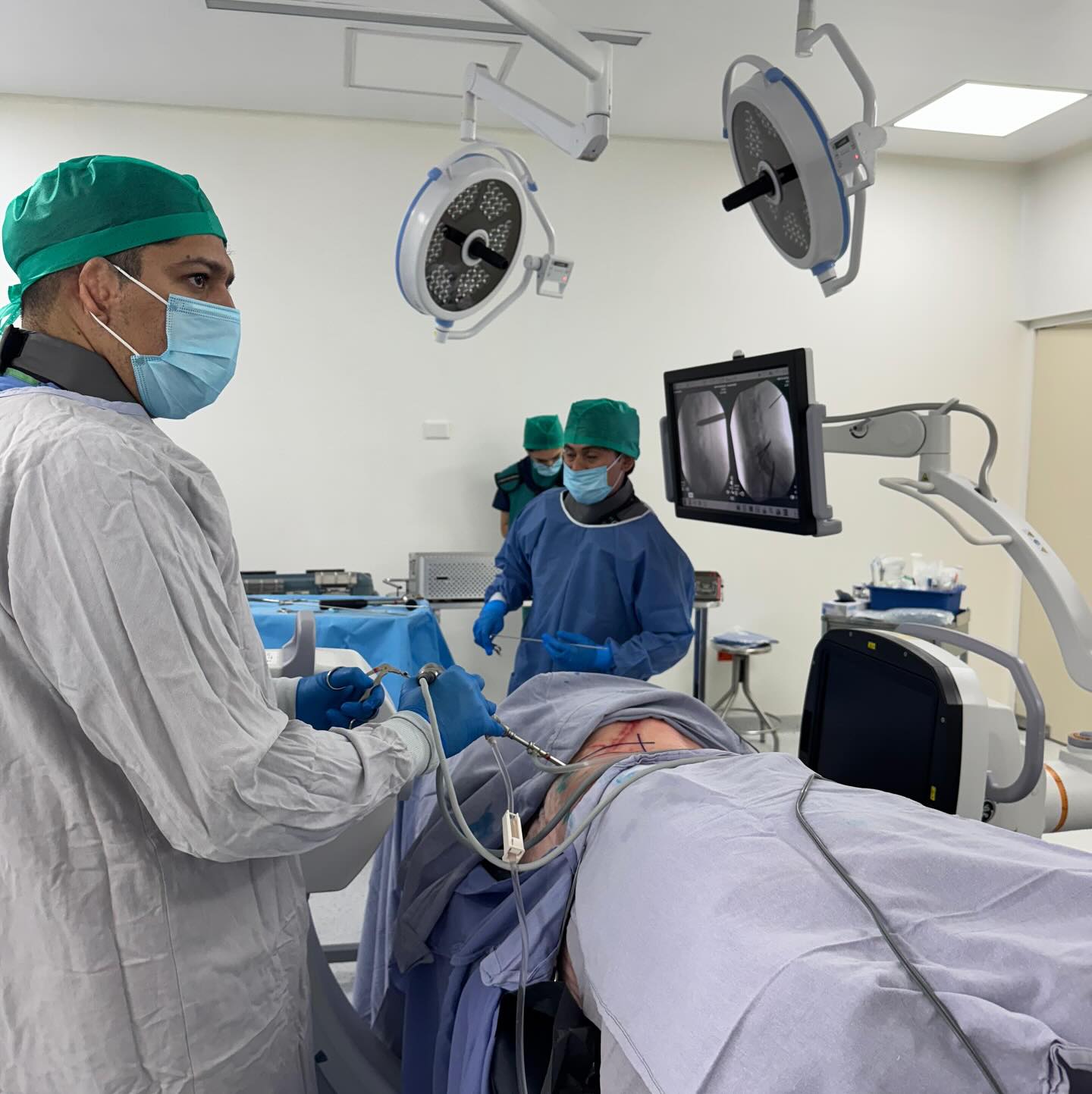 Taller de cirugía endoscopica uniportal de columna en espécimen
#cirugiadecolumna #minimainvasion #cirugiaendoscópica