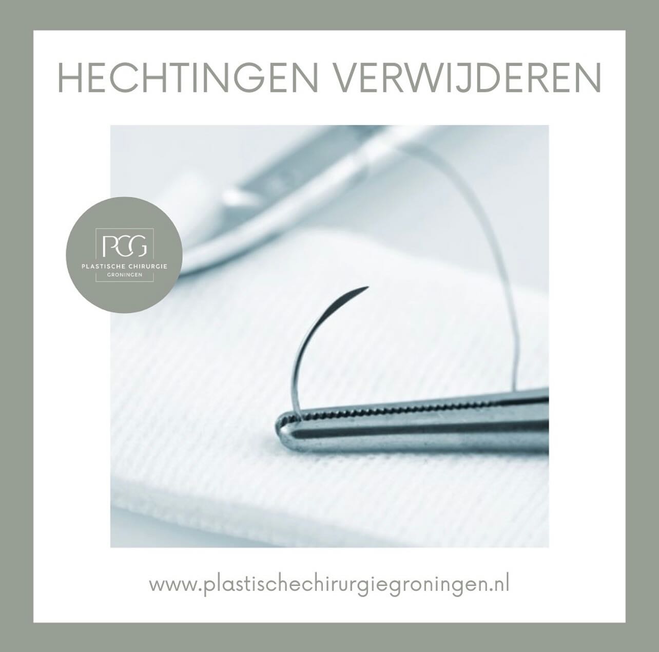 Hechtingen verwijderen na een ooglidcorrectie, hoe gaat dat eigenlijk? 👀
Een week na de operatie kom je terug in onze kliniek voor het verwijderen van de hechtingen.
Het verwijderen van de hechtingen is over het algemeen een eenvoudige en pijnloze procedure. Het kan een beetje gek of gevoelig voelen, maar het is snel klaar. Bij een bovenooglidcorrectie gebruiken we de onderhuidse rijgtechniek, hierdoor hoeft er maar 1 hechtingdraadje verwijderd te worden per ooglid. In enkele gevallen zit er nog een extra “knoop” hechting.
Nadat de hechtingen eruit zijn worden de wondjes schoon gemaakt, hierna ben je klaar en kun je weer naar huis!👍🏽