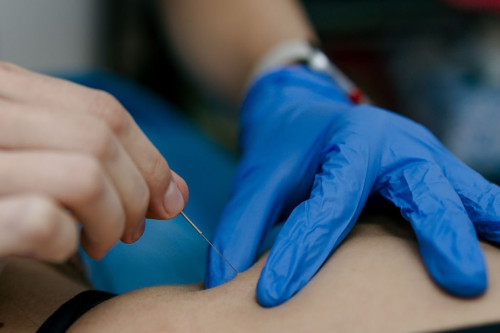 Target pain at its source. Dry needling helps release tight muscles and restore movement — one precise needle at a time.